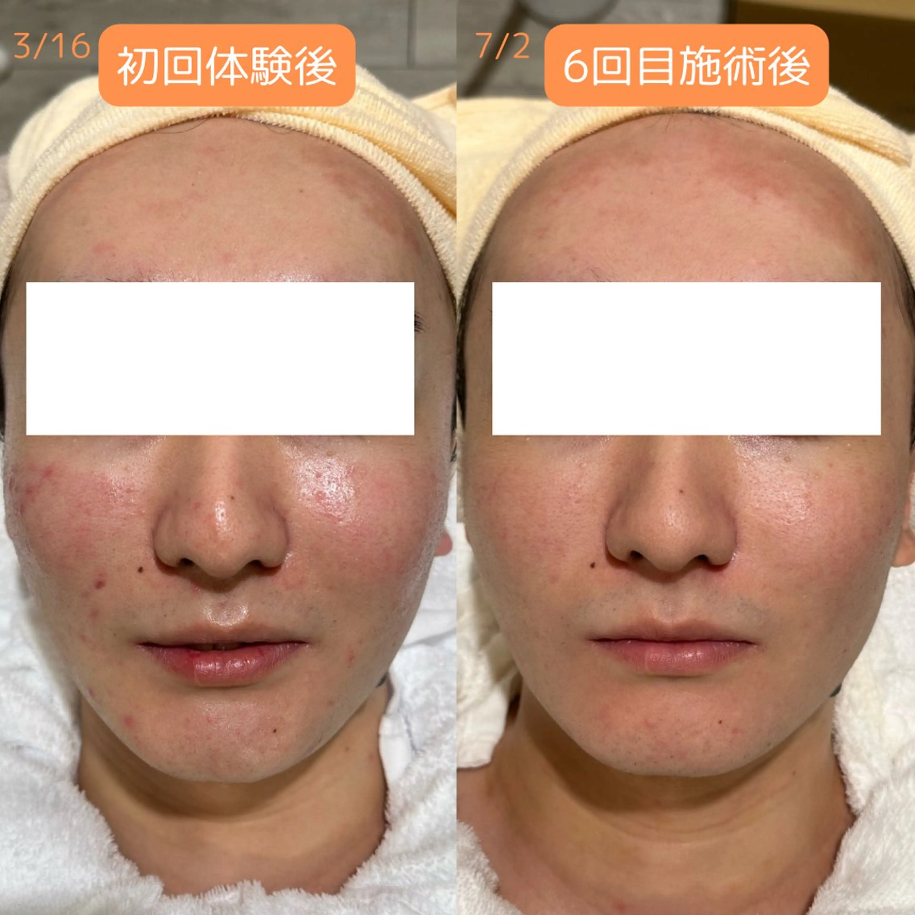 メンズ pansy(パンジー)上野フェイシャルエステ専門店所属・pansy saraのエステ・リラクイメージ