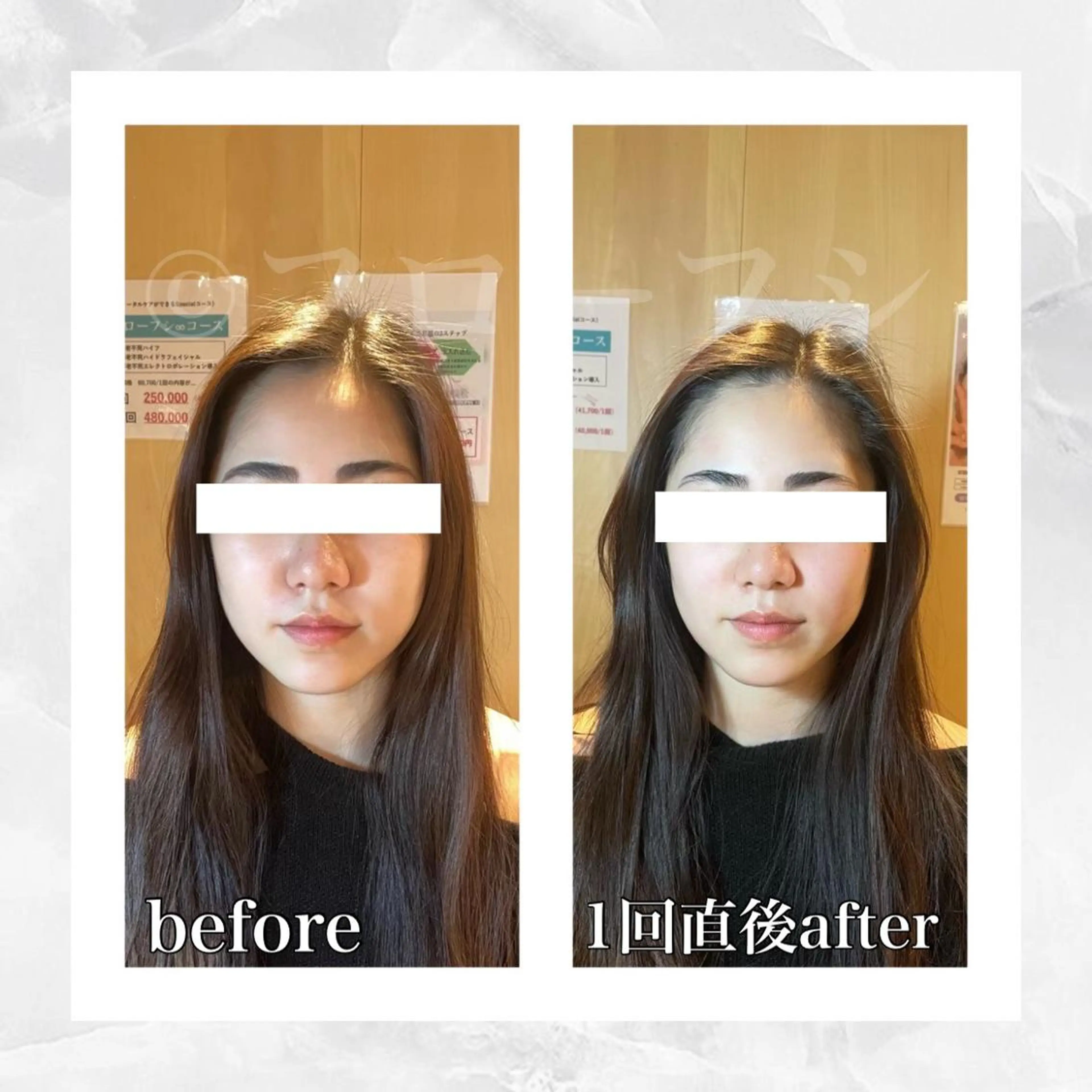 エステ リラク 部分痩せ♥️小顔専門 MIKUのエステ・リラクイメージ