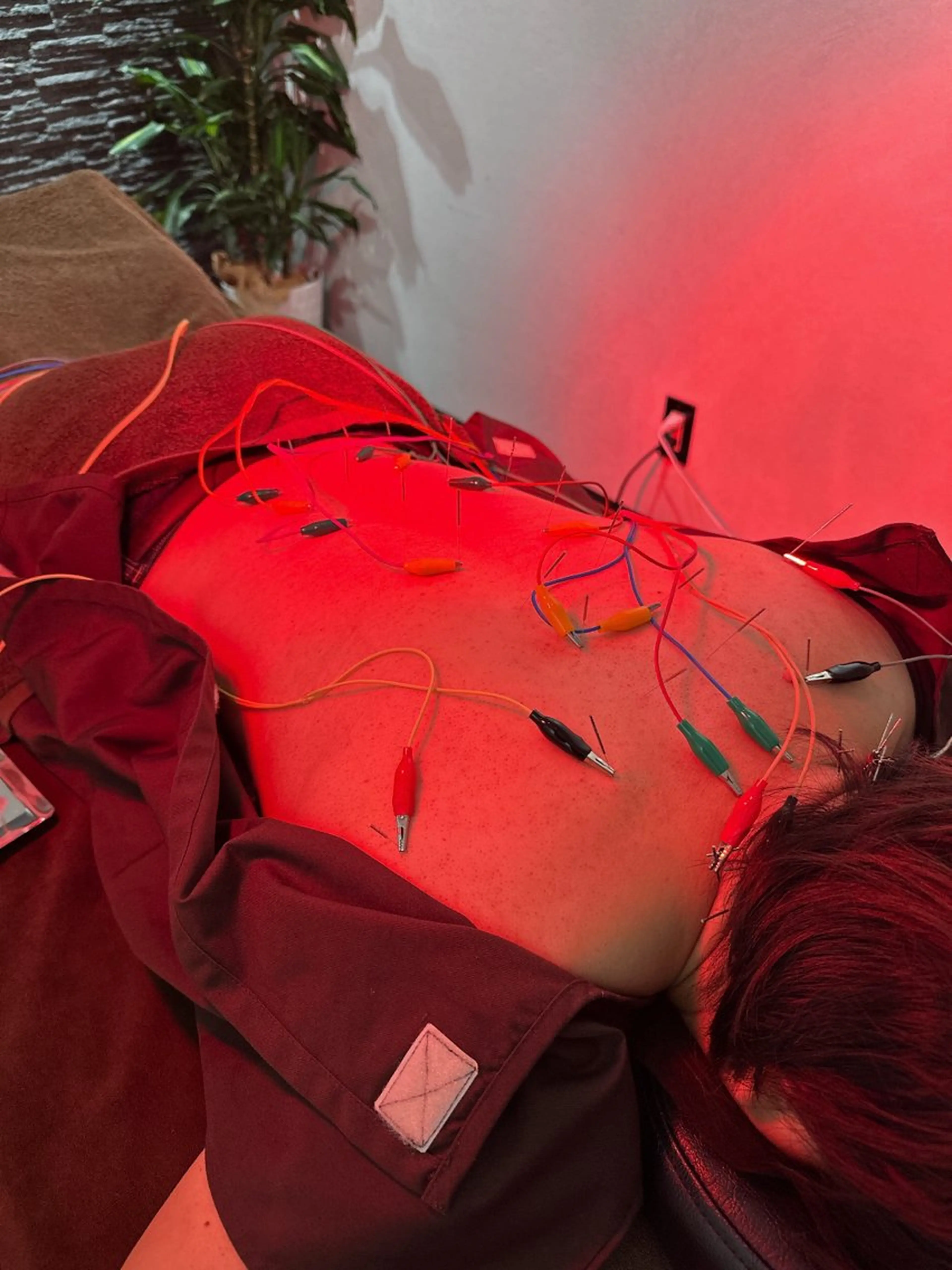 その他 美容鍼灸整体サロンBeauJu所属・小顔矯/美容鍼/鍼灸 BeauJuのその他イメージ