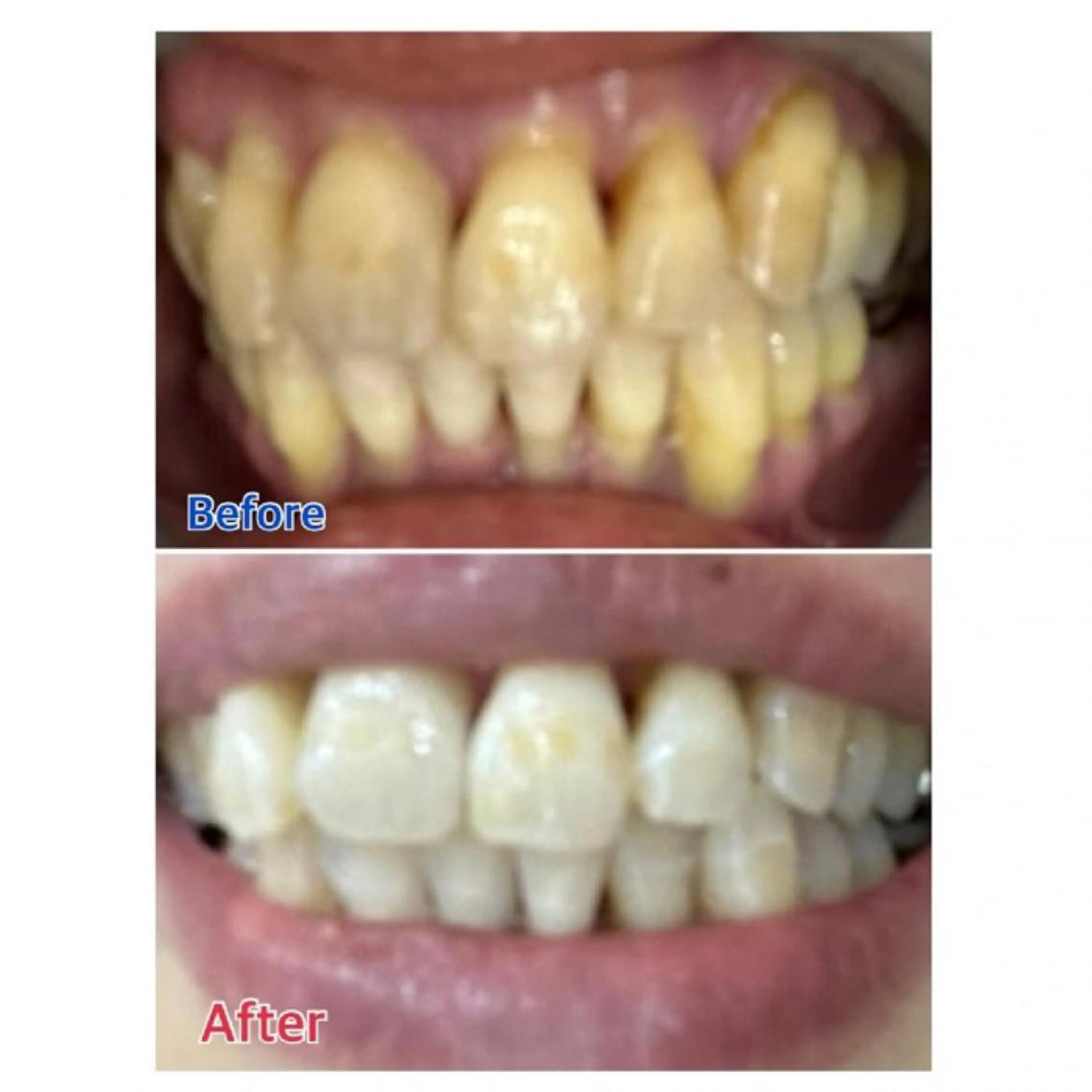 M渋谷店所属・Ｍ渋谷 ホワイトニングのその他イメージ