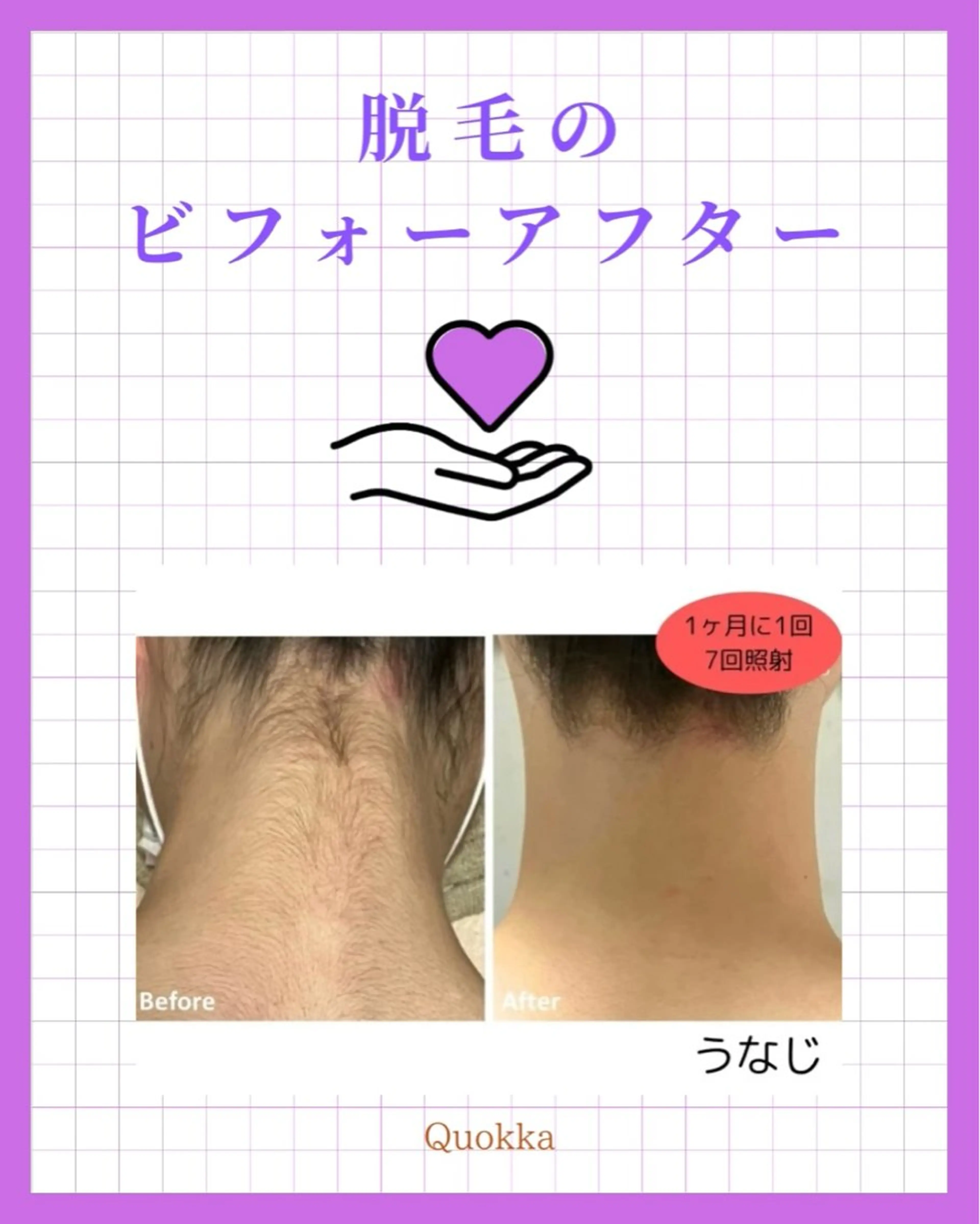 脱毛 Quokka ✴︎ あま市甚目寺のエステ・リラクイメージ