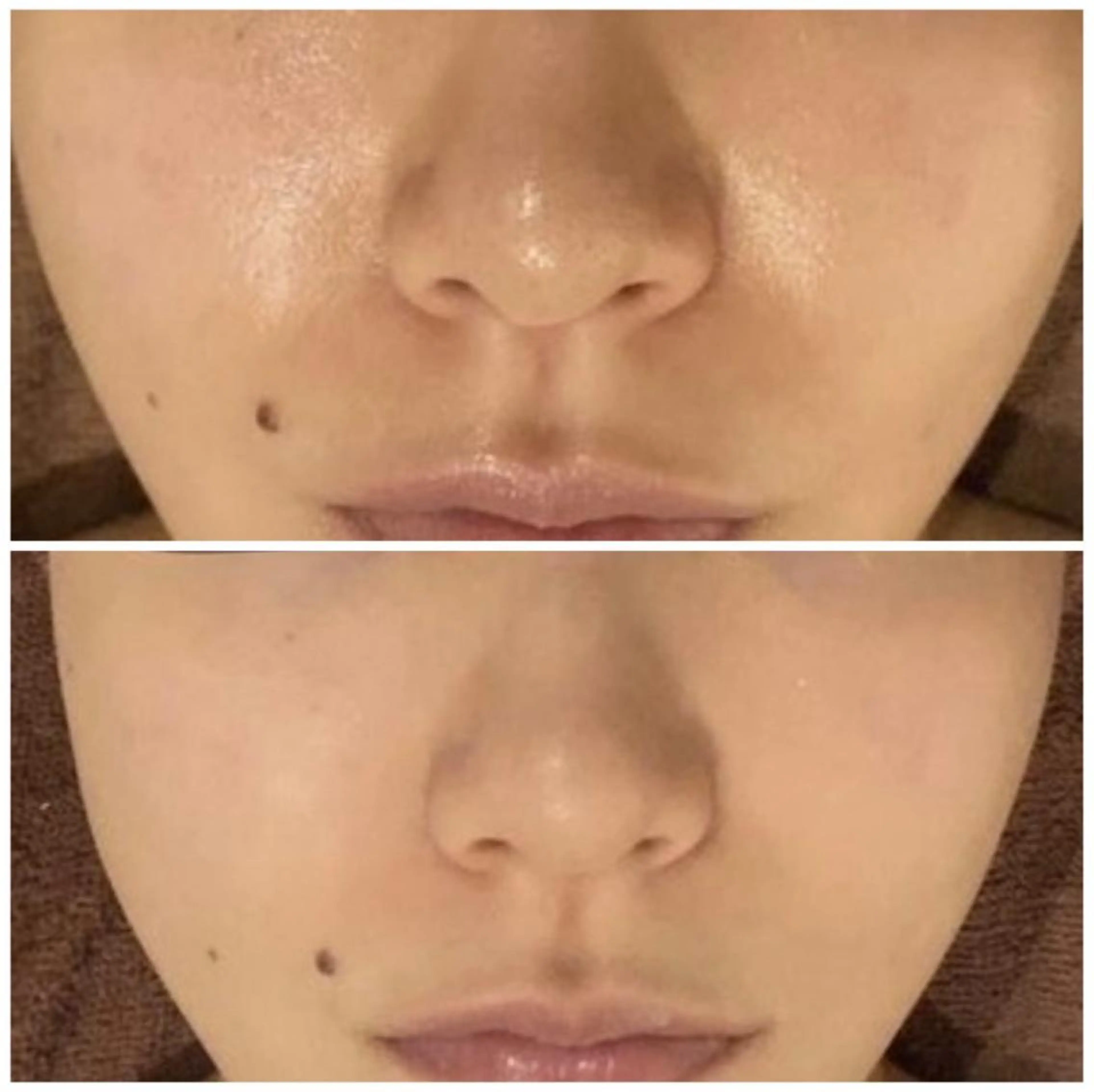 ニキビ・肌質改善専門 ♡人生が変わるサロンのエステ・リラクイメージ