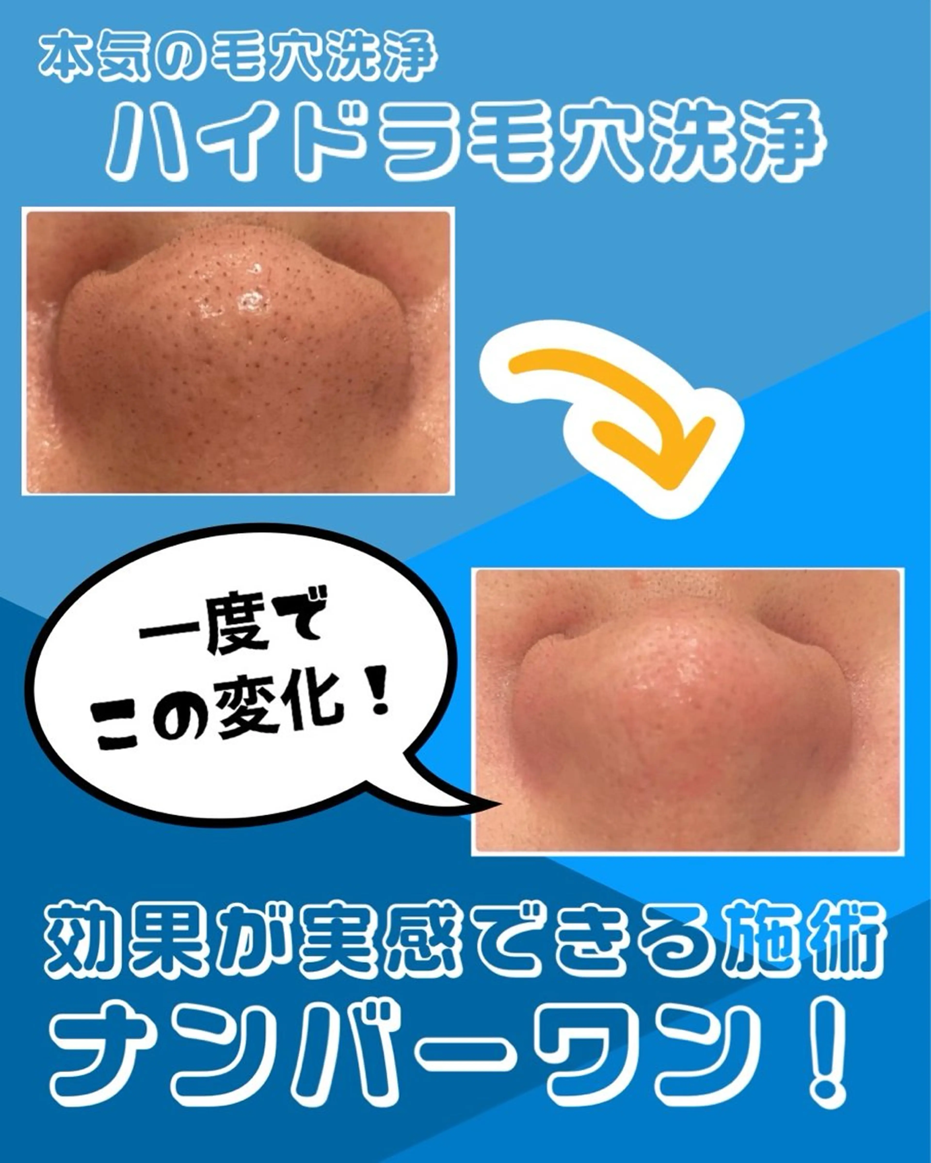 メンズ エステ 美Face所属・美 Faceのエステ・リラクイメージ