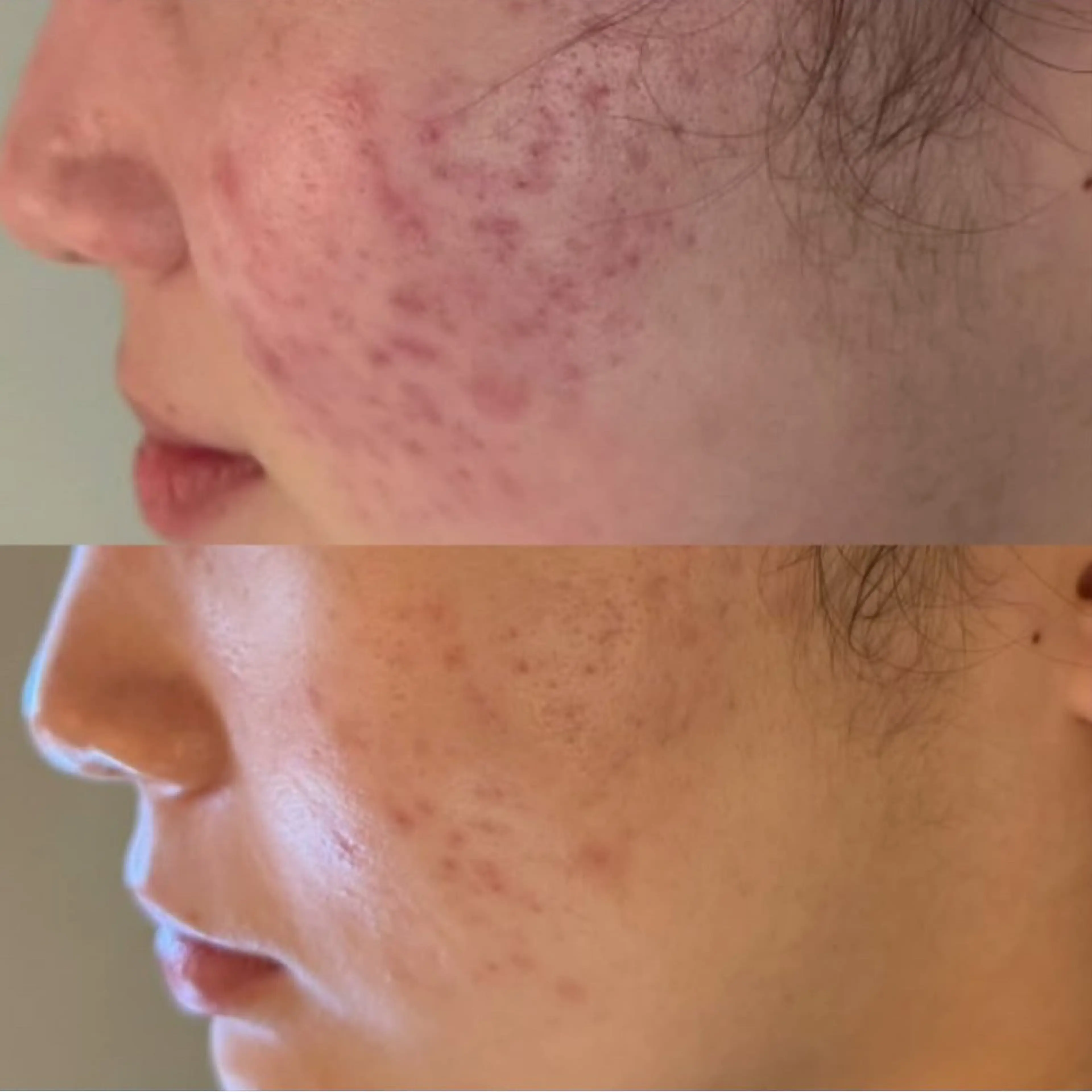 メンズ Blooming所属・LOUISE. ／肌質・頭皮のエステ・リラクイメージ