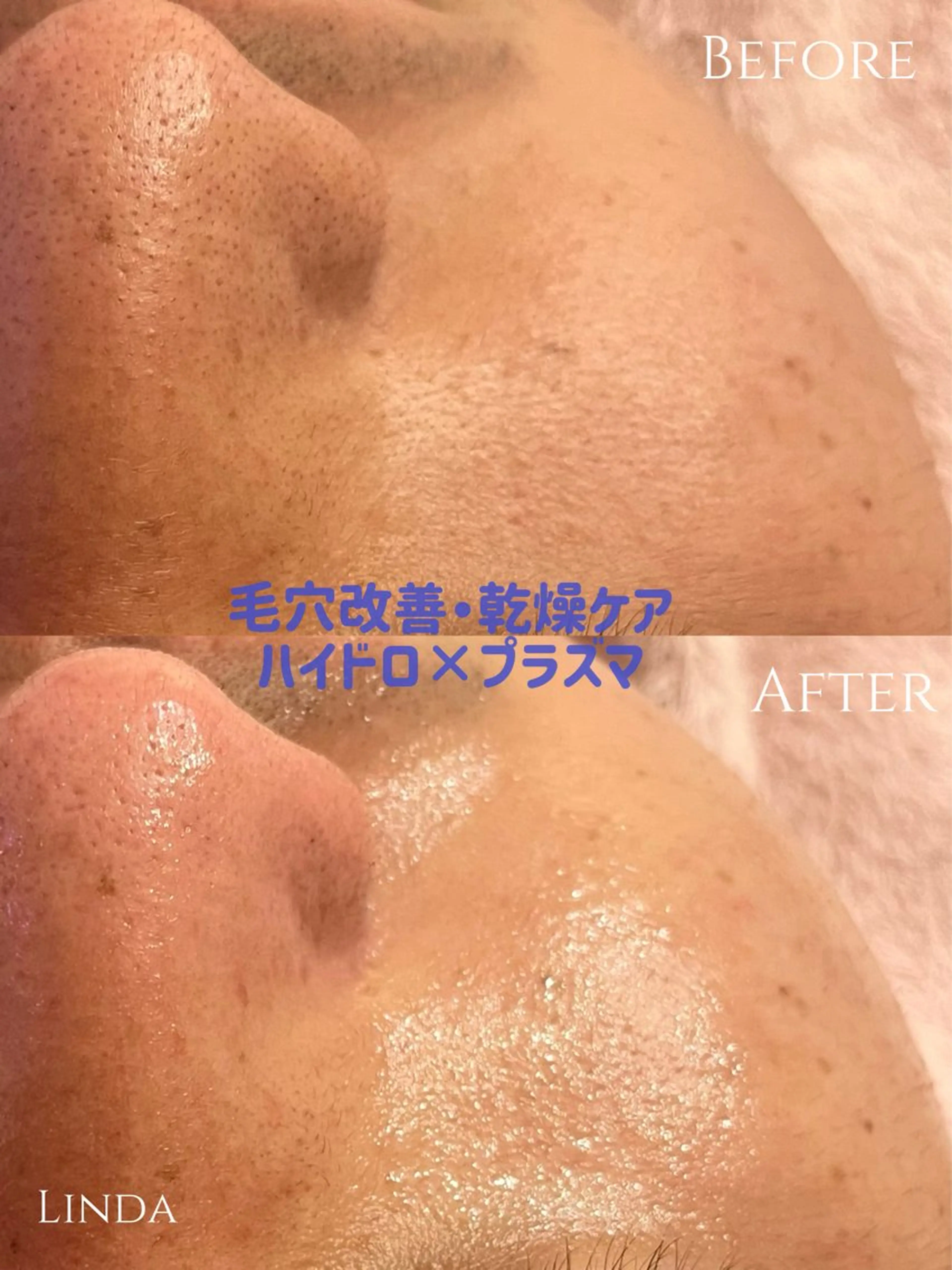 その他 アイラッシュ&エステサロンLinda西宮所属・小顔&毛穴・肌質改善 LINDA西宮 AIのエステ・リラクイメージ