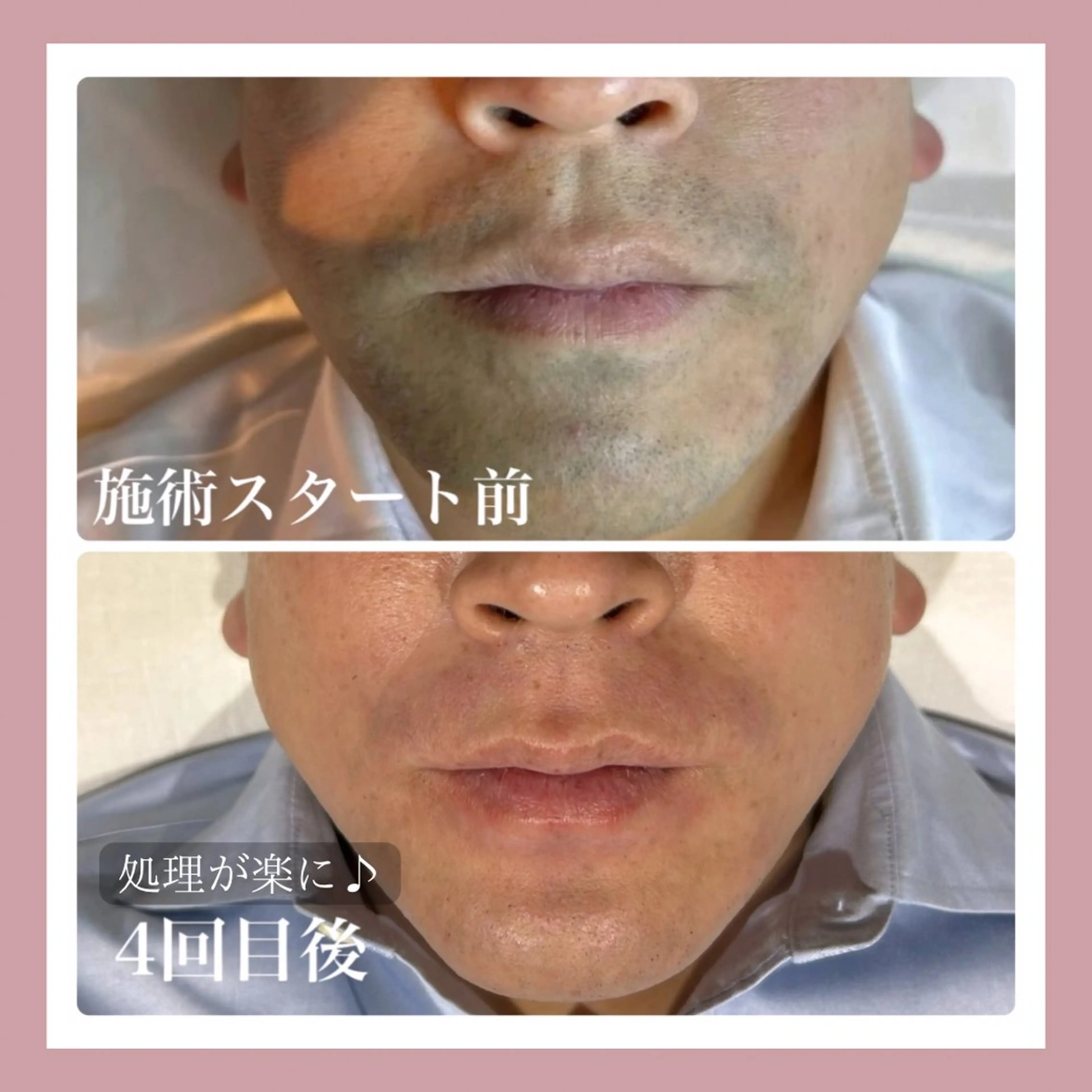 美肌脱毛&毛穴専門 Nico🐰ྀི♡のエステ・リラクイメージ