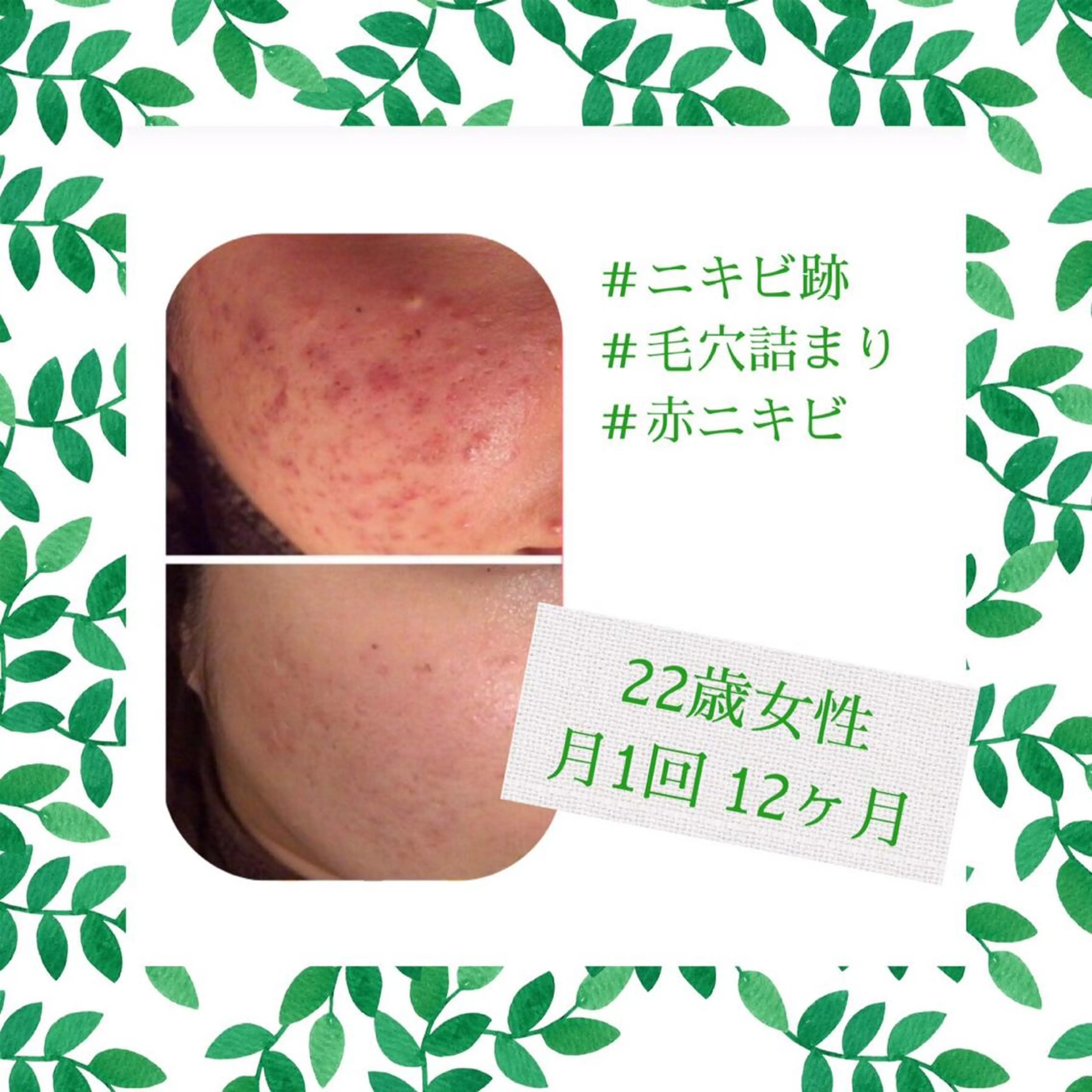 ミディアム カラー パーマ ヘアアレンジ メンズ キッズ ネイル マツエク・マツパ エステ リラク ニキビ・肌質改善専門 ♡人生が変わるサロンのエステ・リラクイメージ