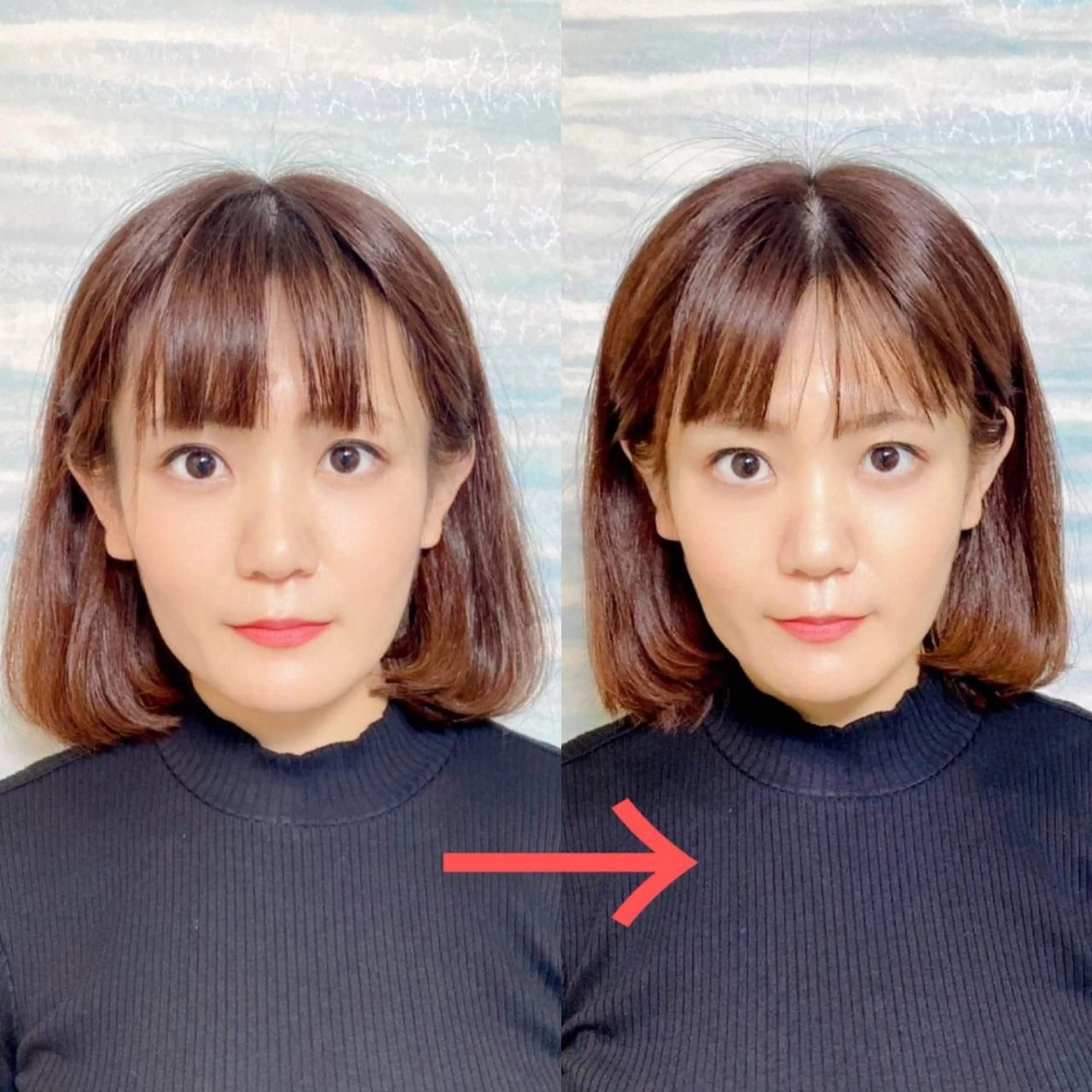 小顔矯正の撮影モデル募集！！の写真