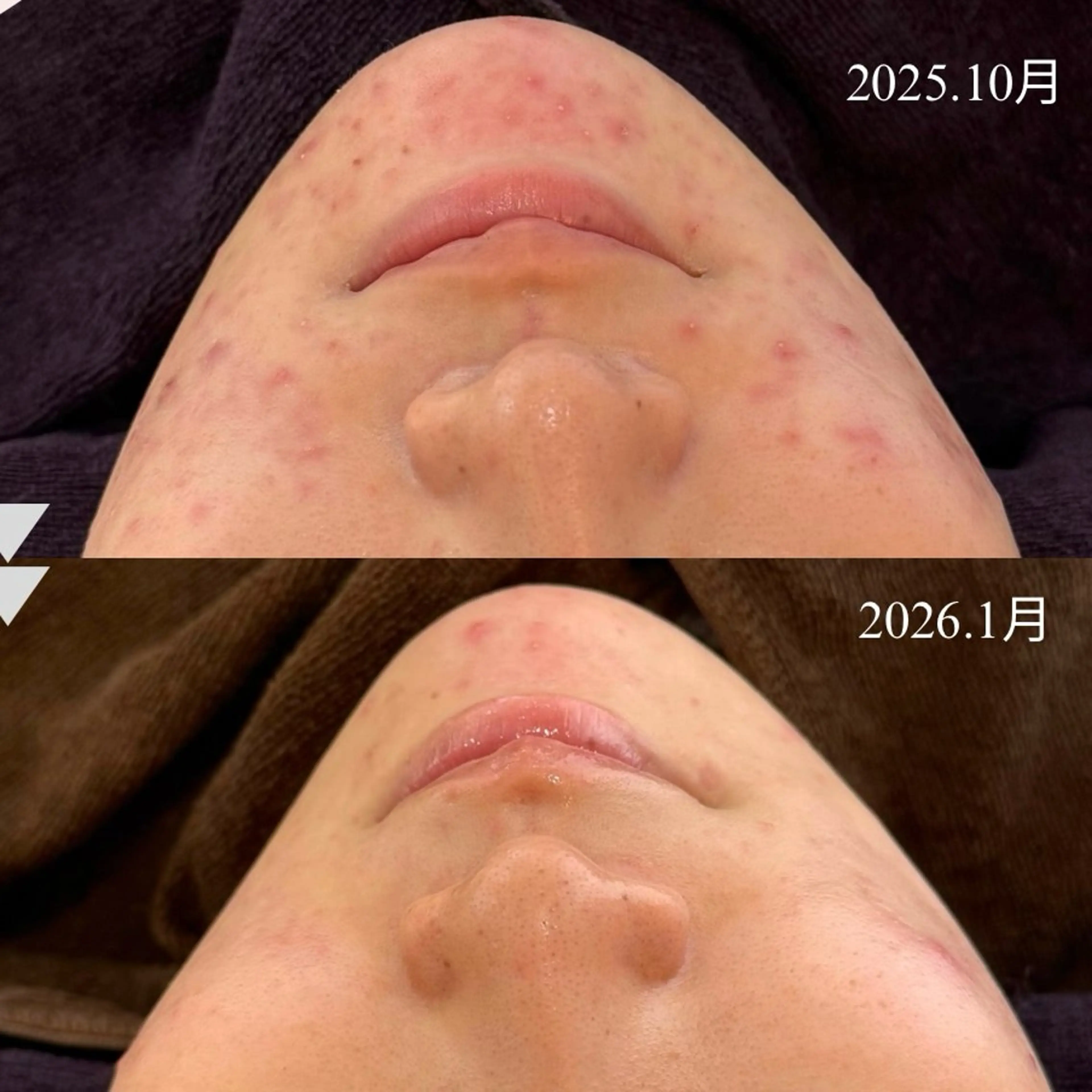 エステ écla【中崎町】 yukikoのエステ・リラクイメージ