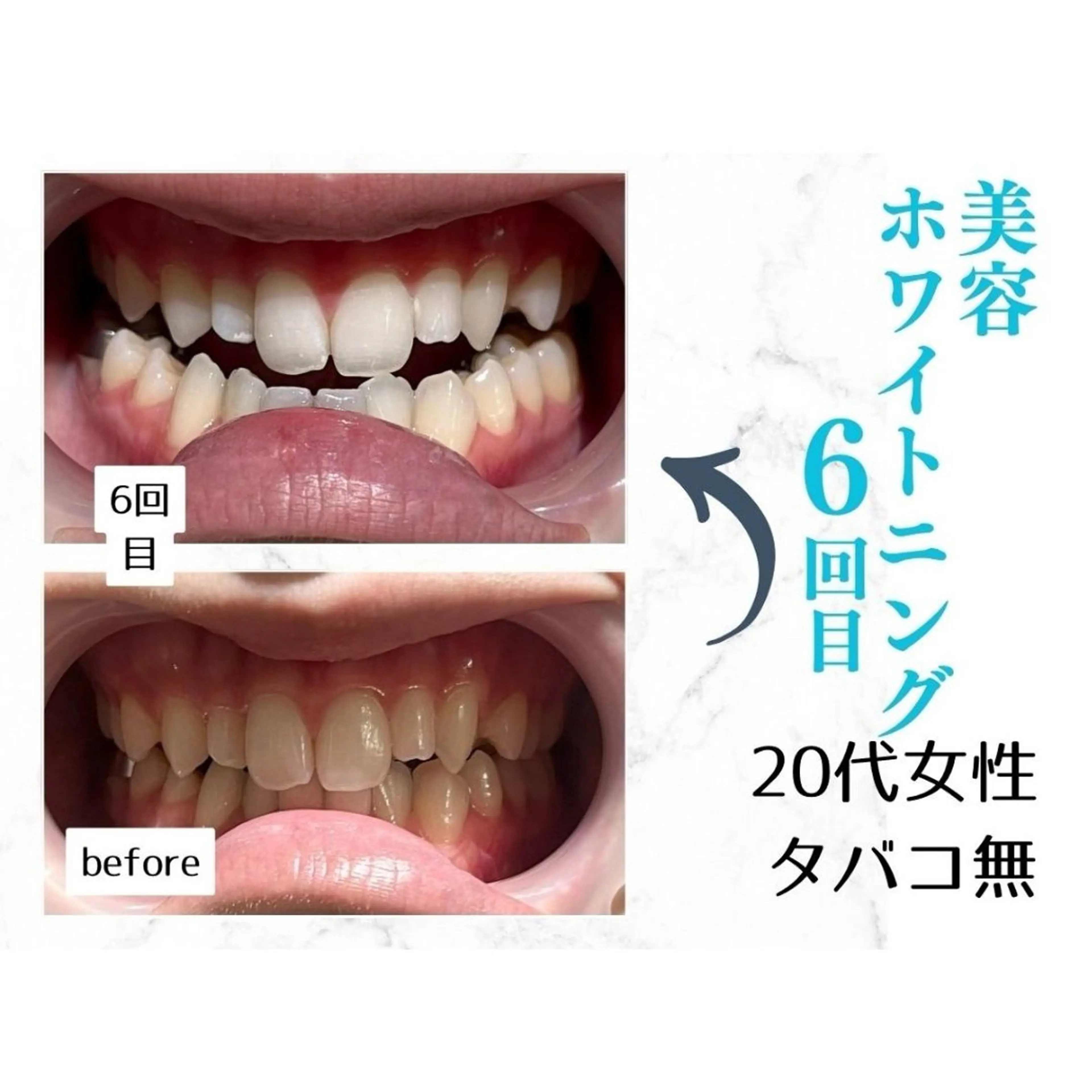 ホワイトニングサロン le  canonのその他イメージ