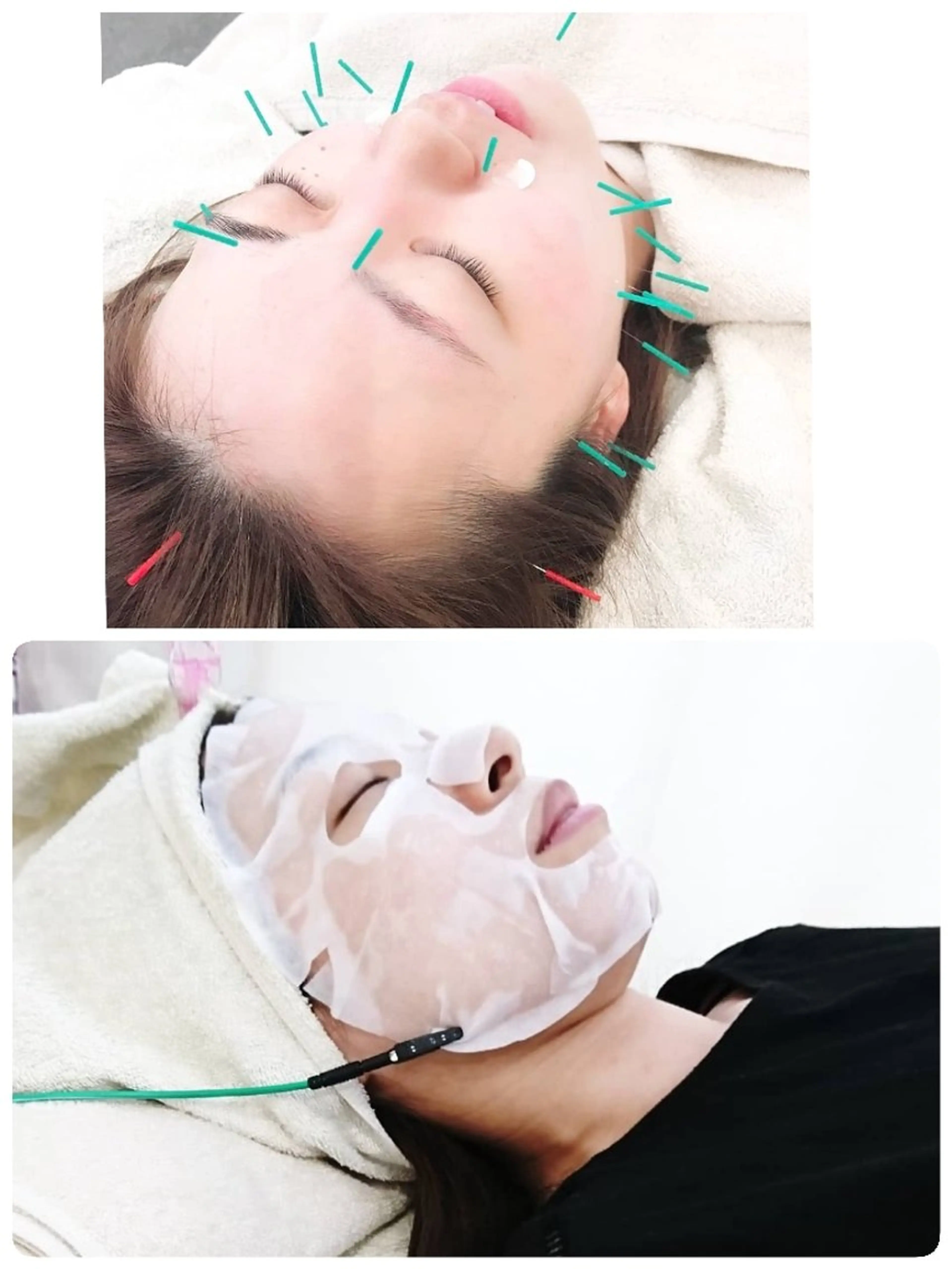 エステ リラク ヒロスポーツ 鍼灸整骨院のエステ・リラクイメージ