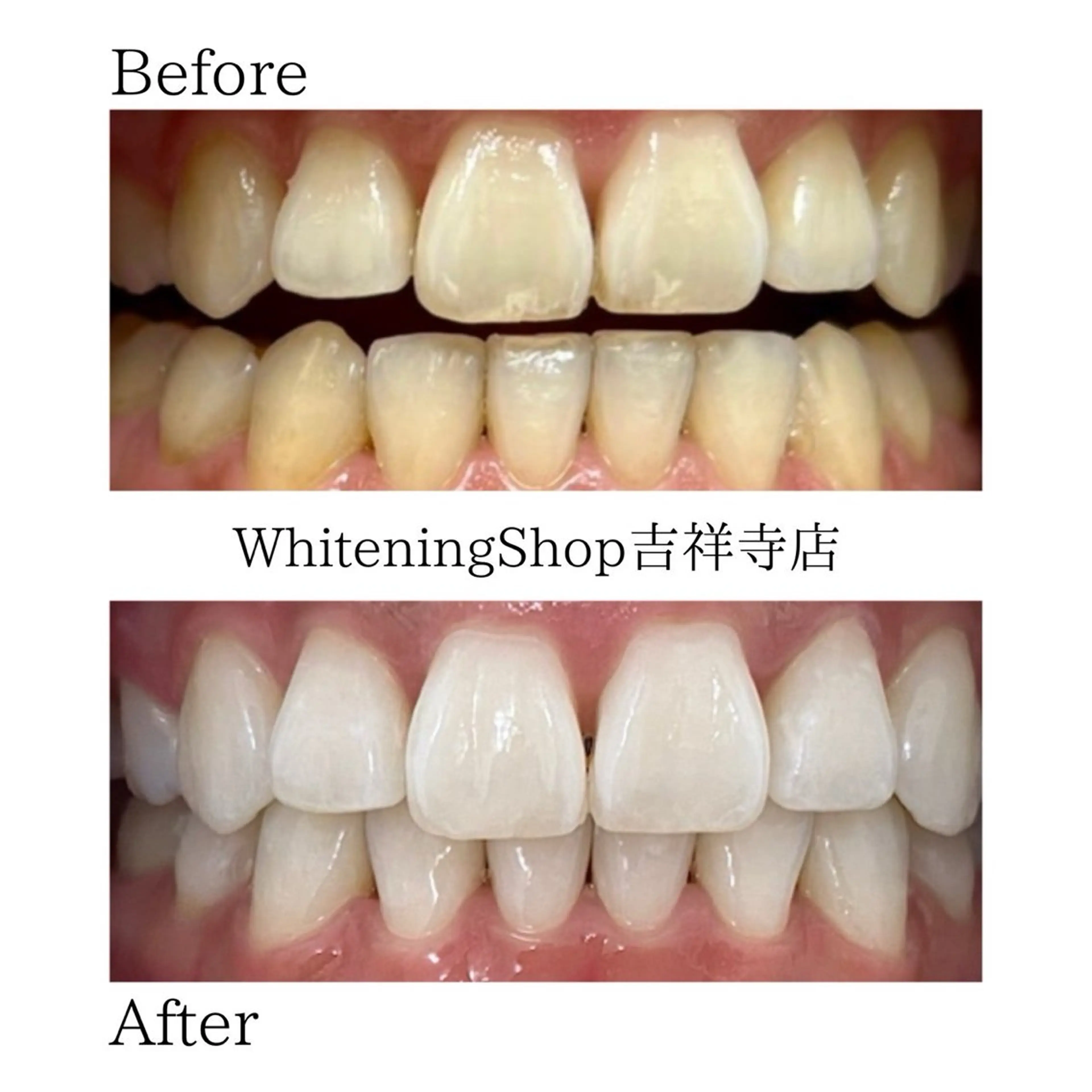 エステ リラク ホワイトニング ショップ吉祥寺店のエステ・リラクイメージ