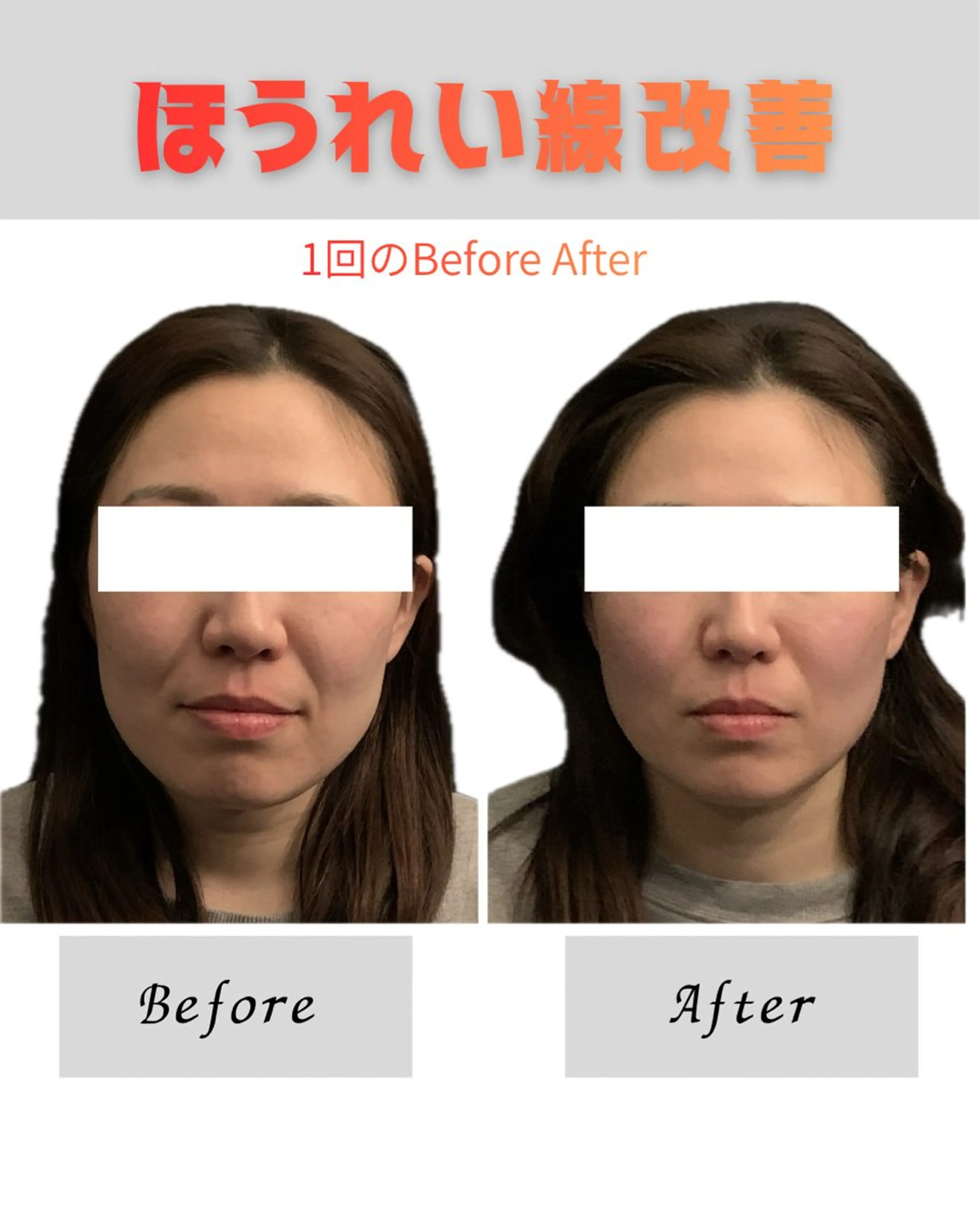 Re mのエステ・リラクイメージ