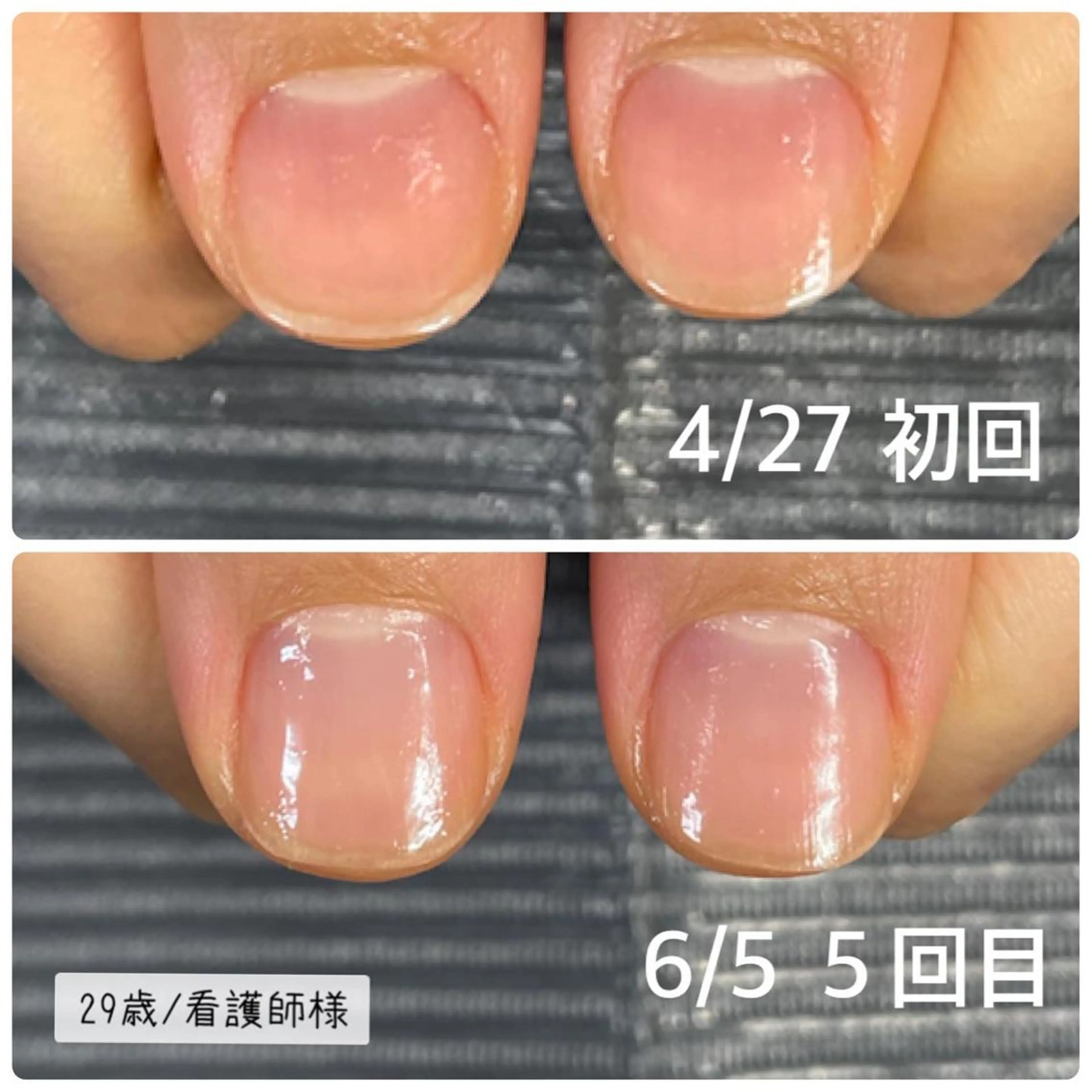 ネイル 奥園 良恵のネイルデザイン