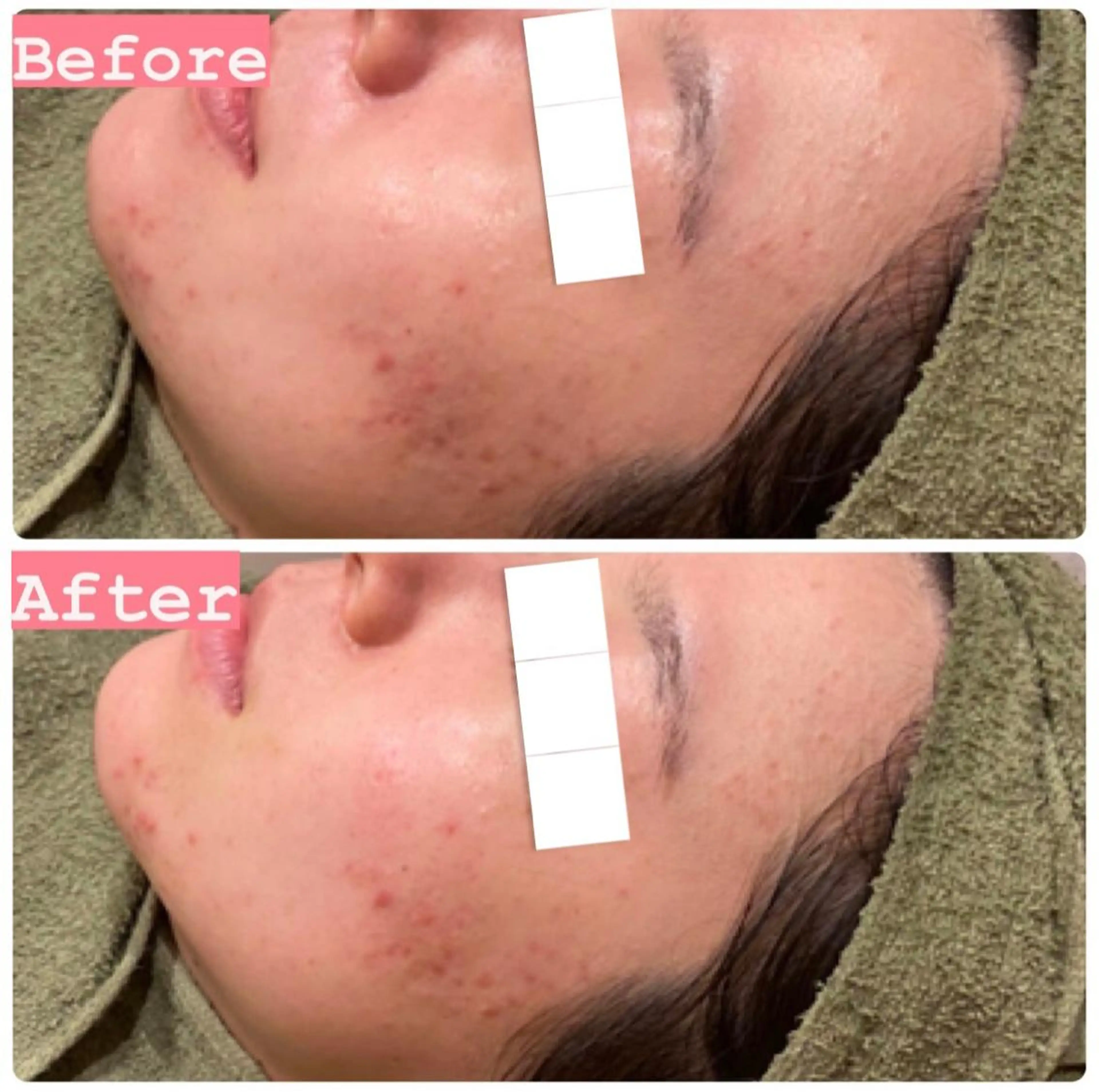 ハーブピーリング専門 muro.のエステ・リラクイメージ