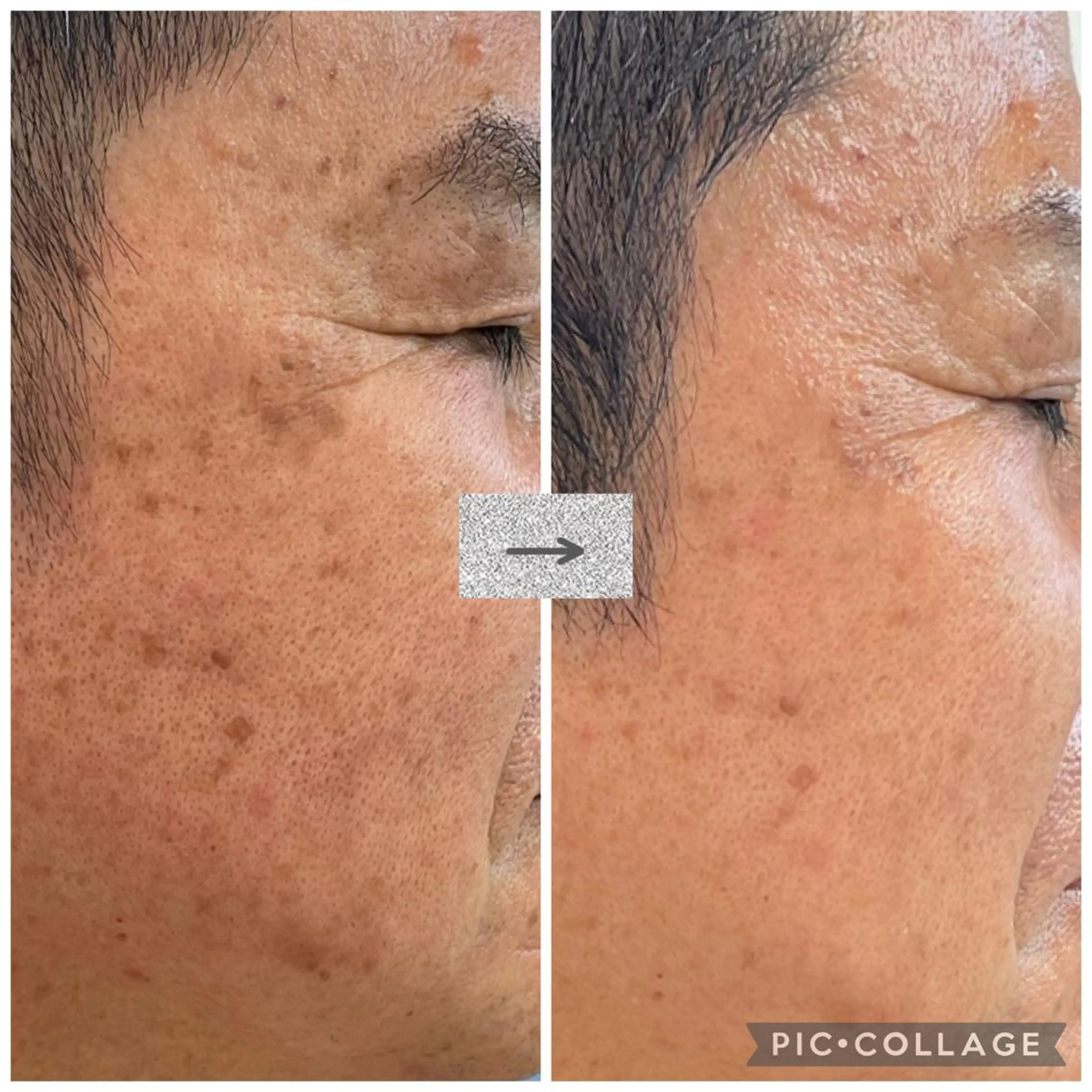 トータルビューティーサロン LilyRose所属・エステサロン LilyRoseのエステ・リラクイメージ