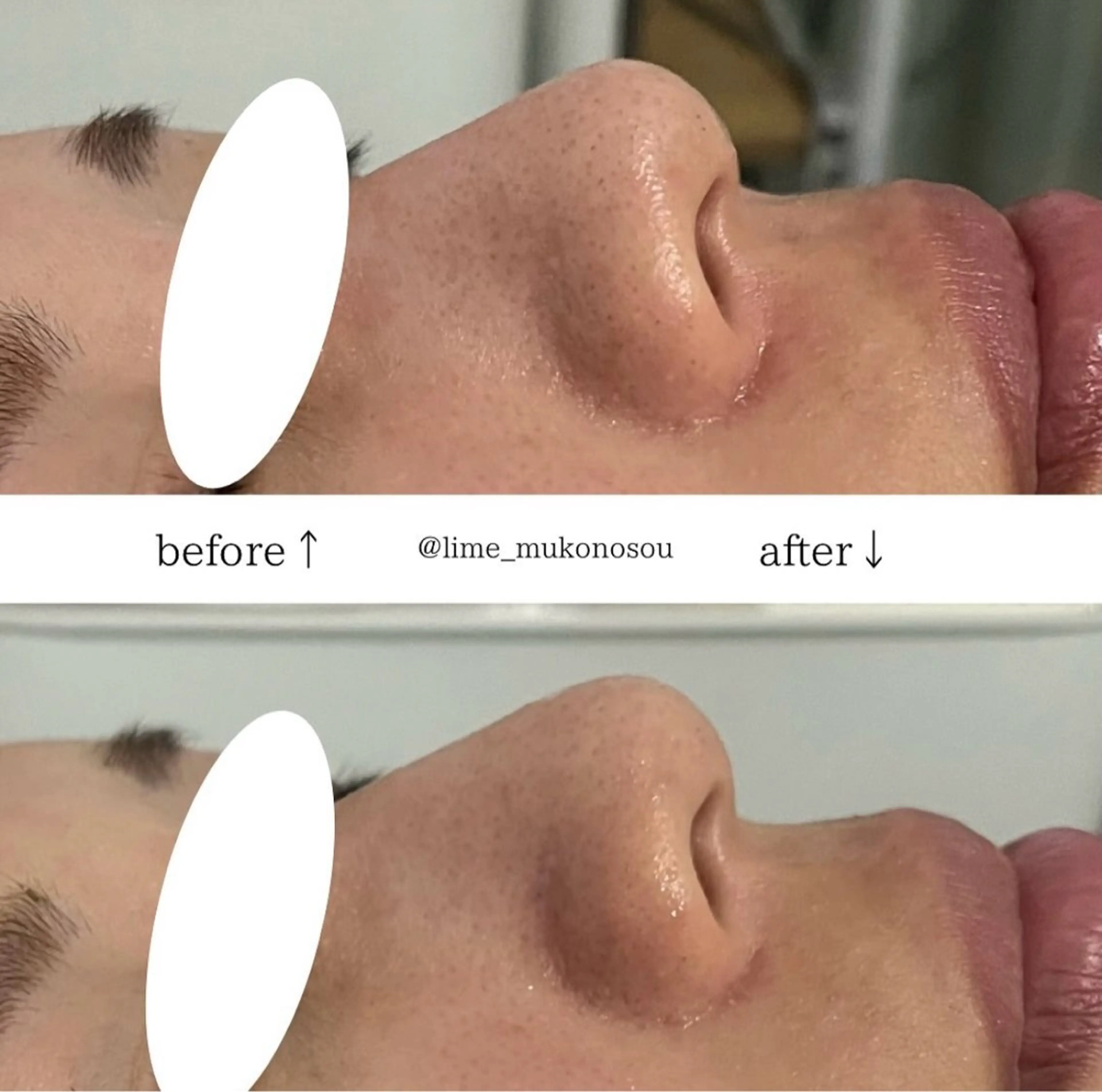 LIME武庫之荘所属・LIME 武庫之荘店のエステ・リラクイメージ