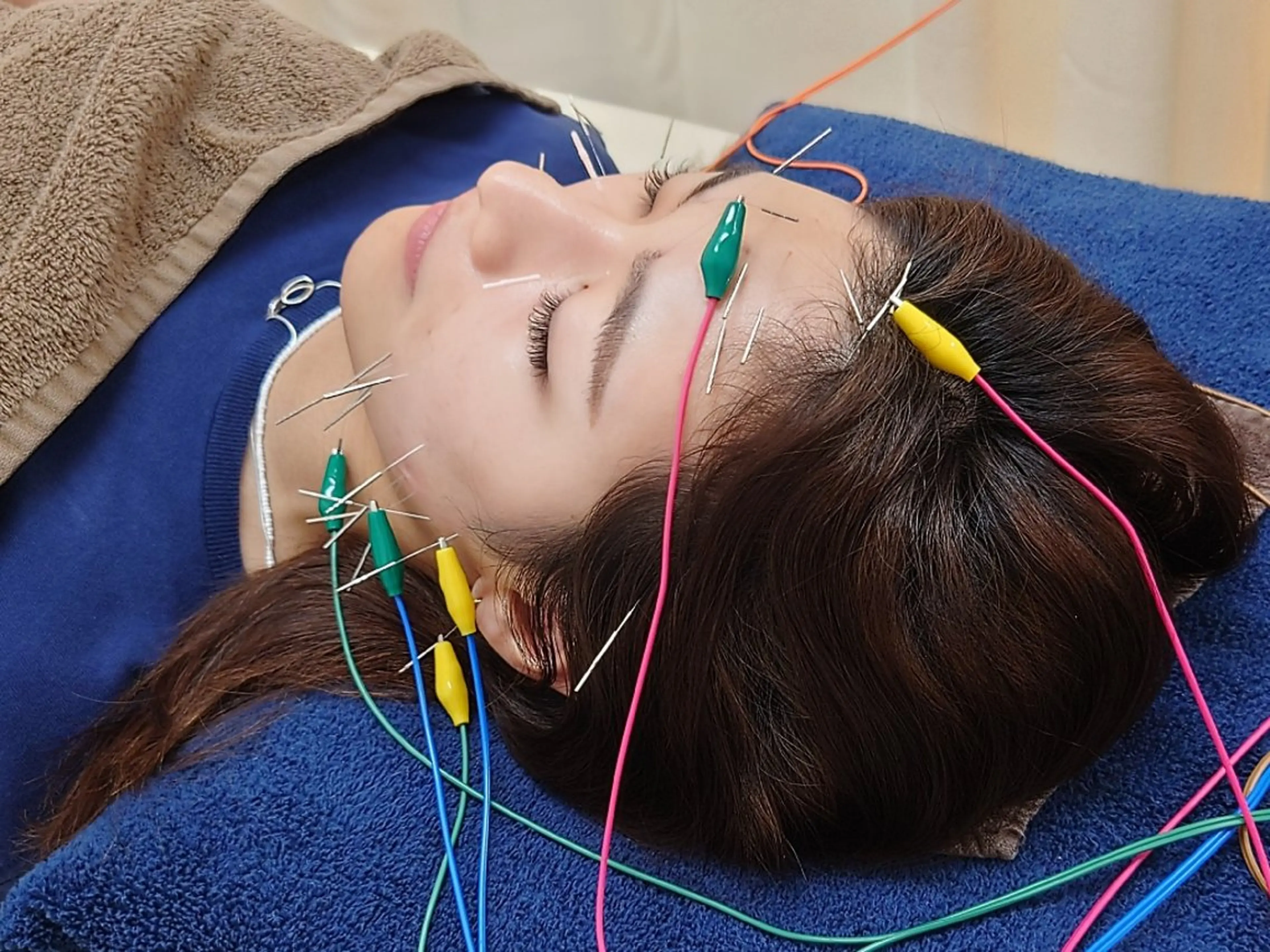 スカイブルー 鍼灸接骨院　佐々木のエステ・リラクイメージ