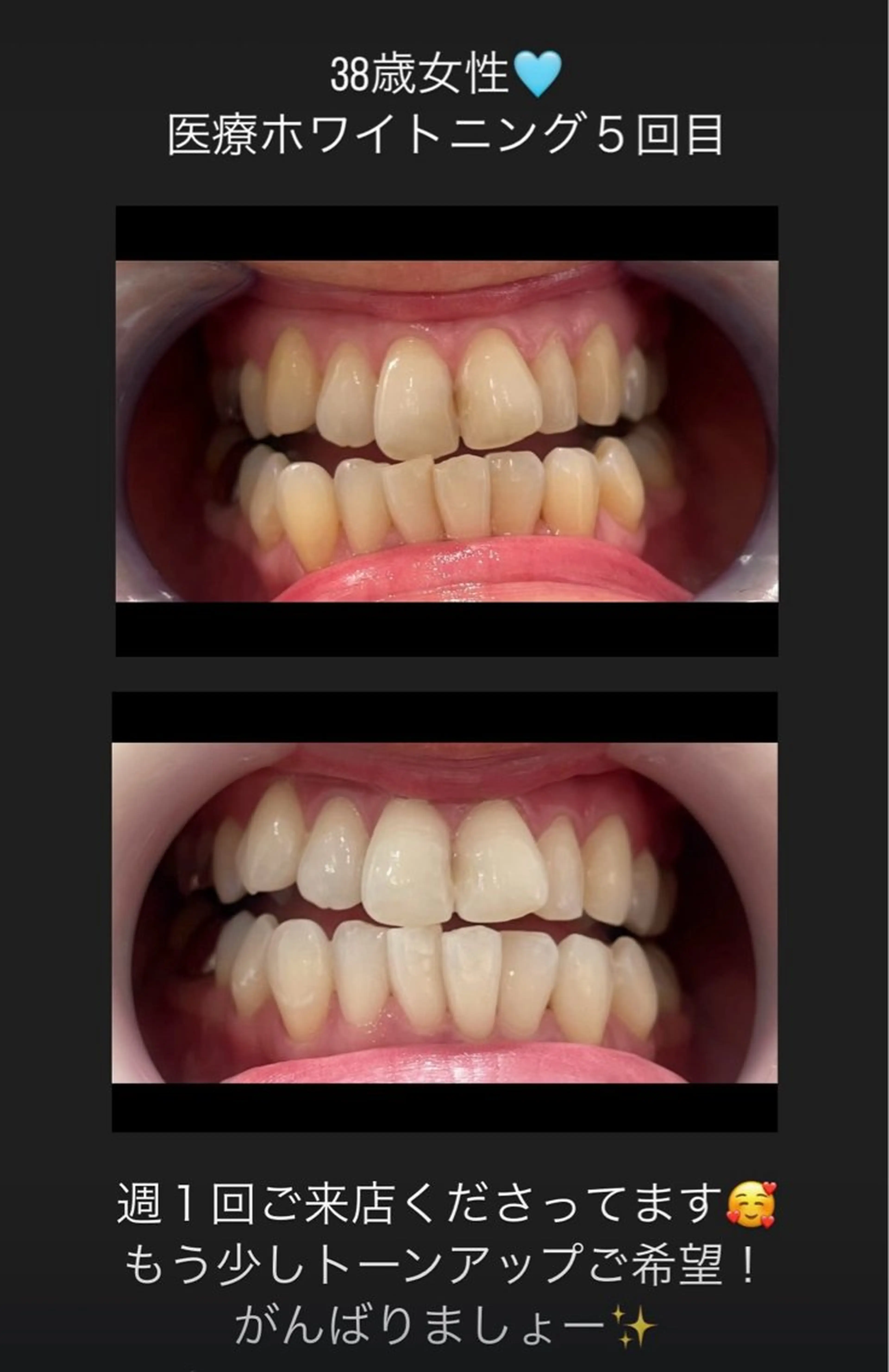 Kaula所属・Kaula ホワイトニング耳ツボのその他イメージ