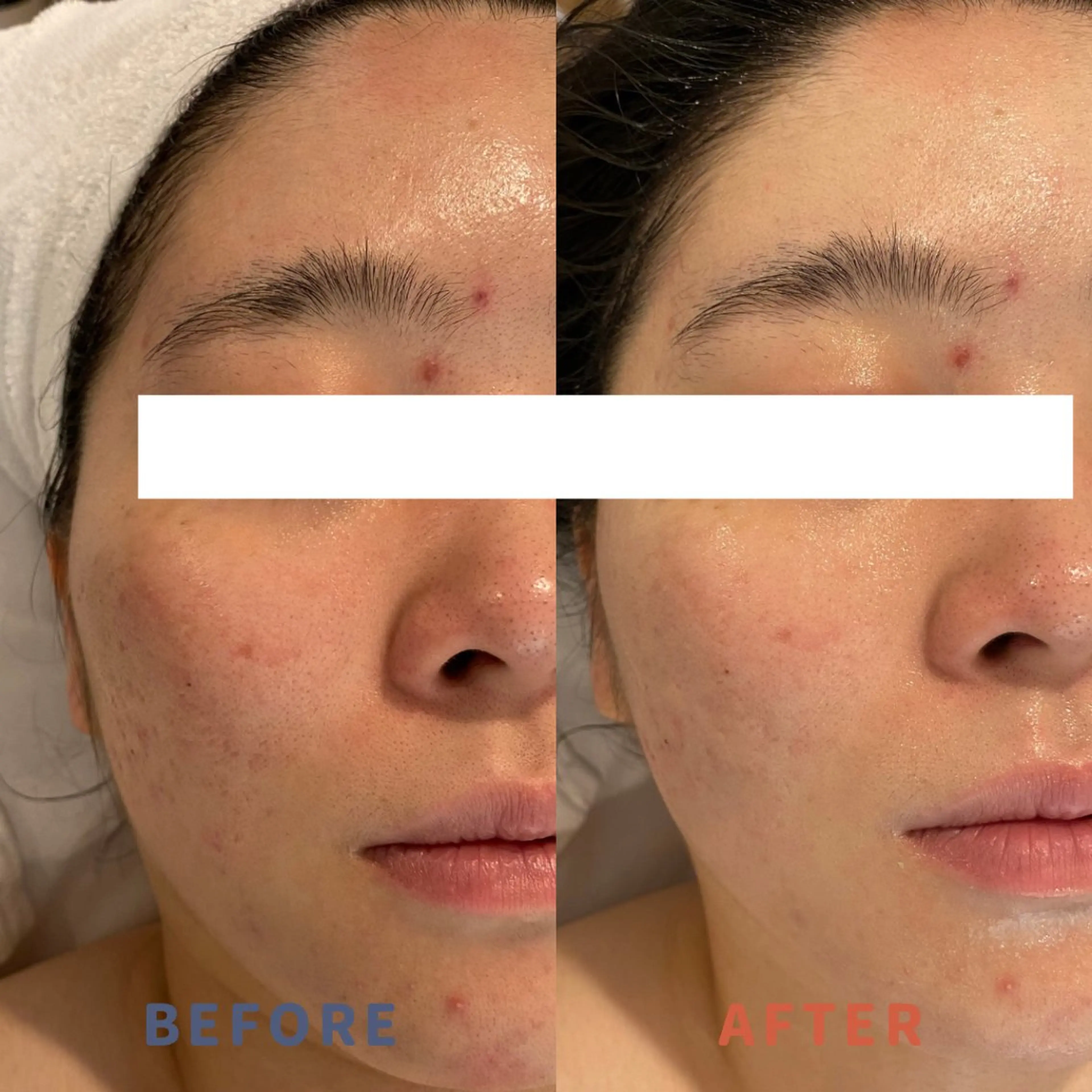 エステと焼き菓子 レモンバームソワンのエステ・リラクイメージ