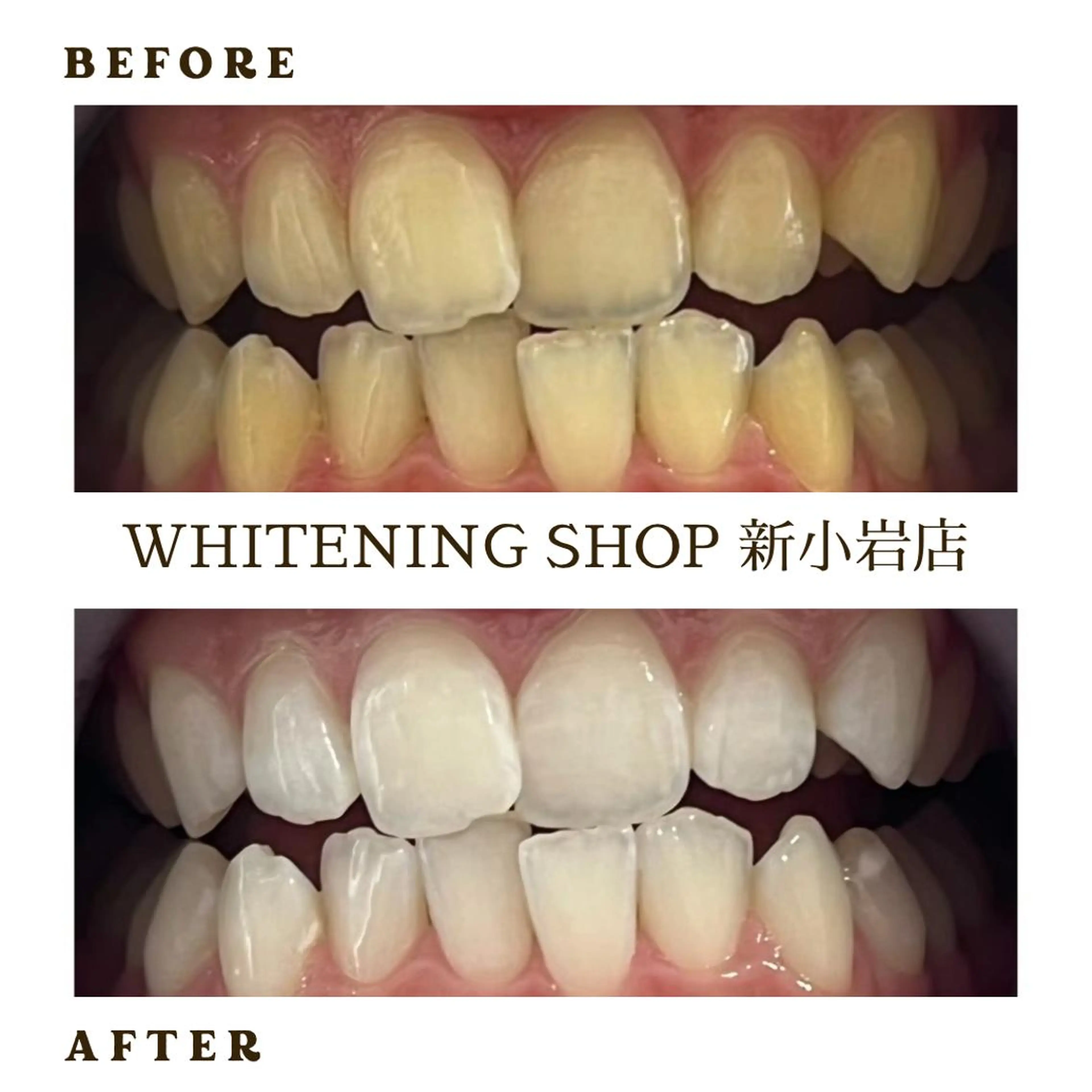 メンズ その他 ホワイトニング ショップ新小岩店のその他イメージ