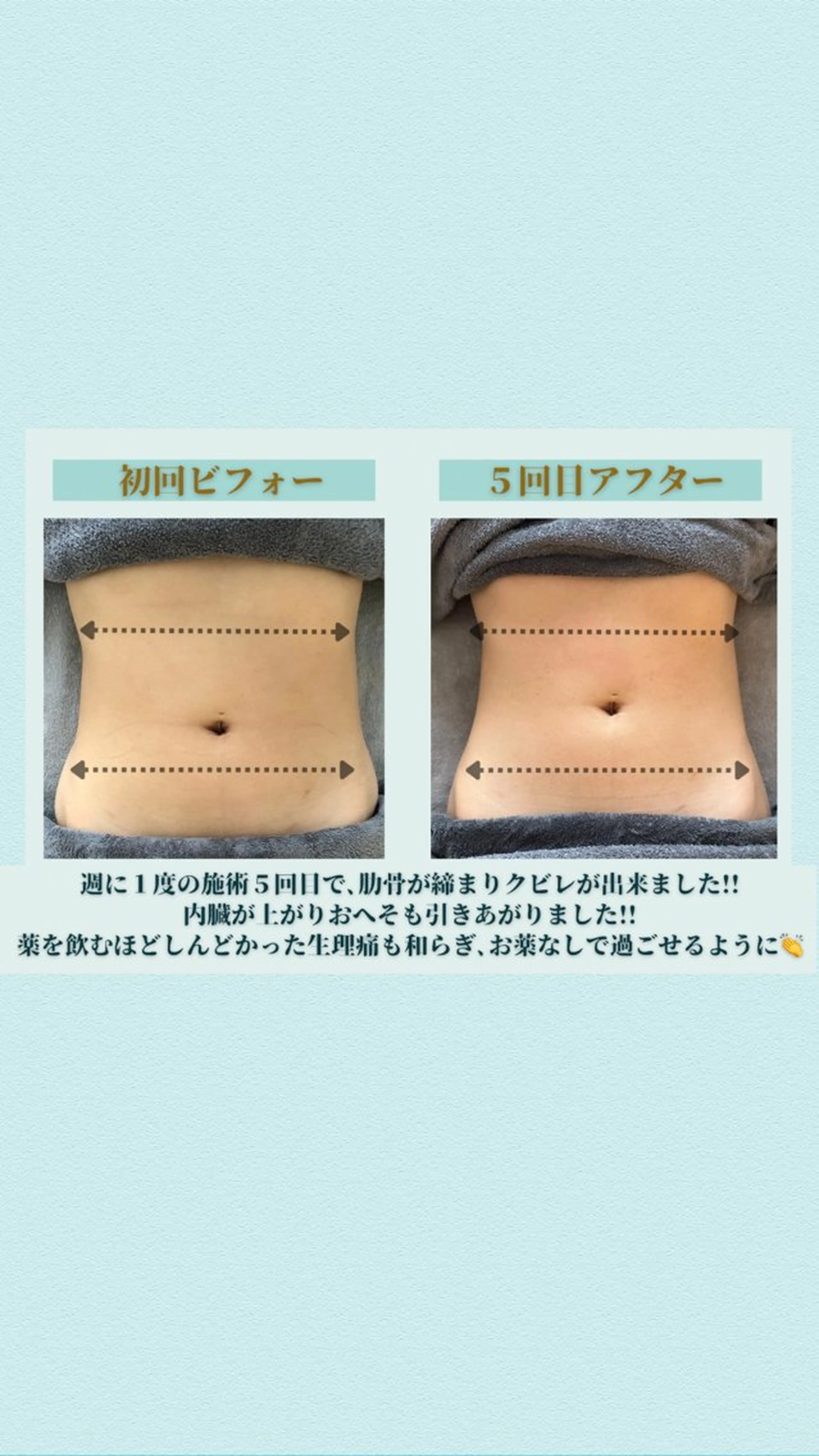 夏までにくびれ出し◎腸もみ60分（カウンセリング5-10分）5,900円の写真