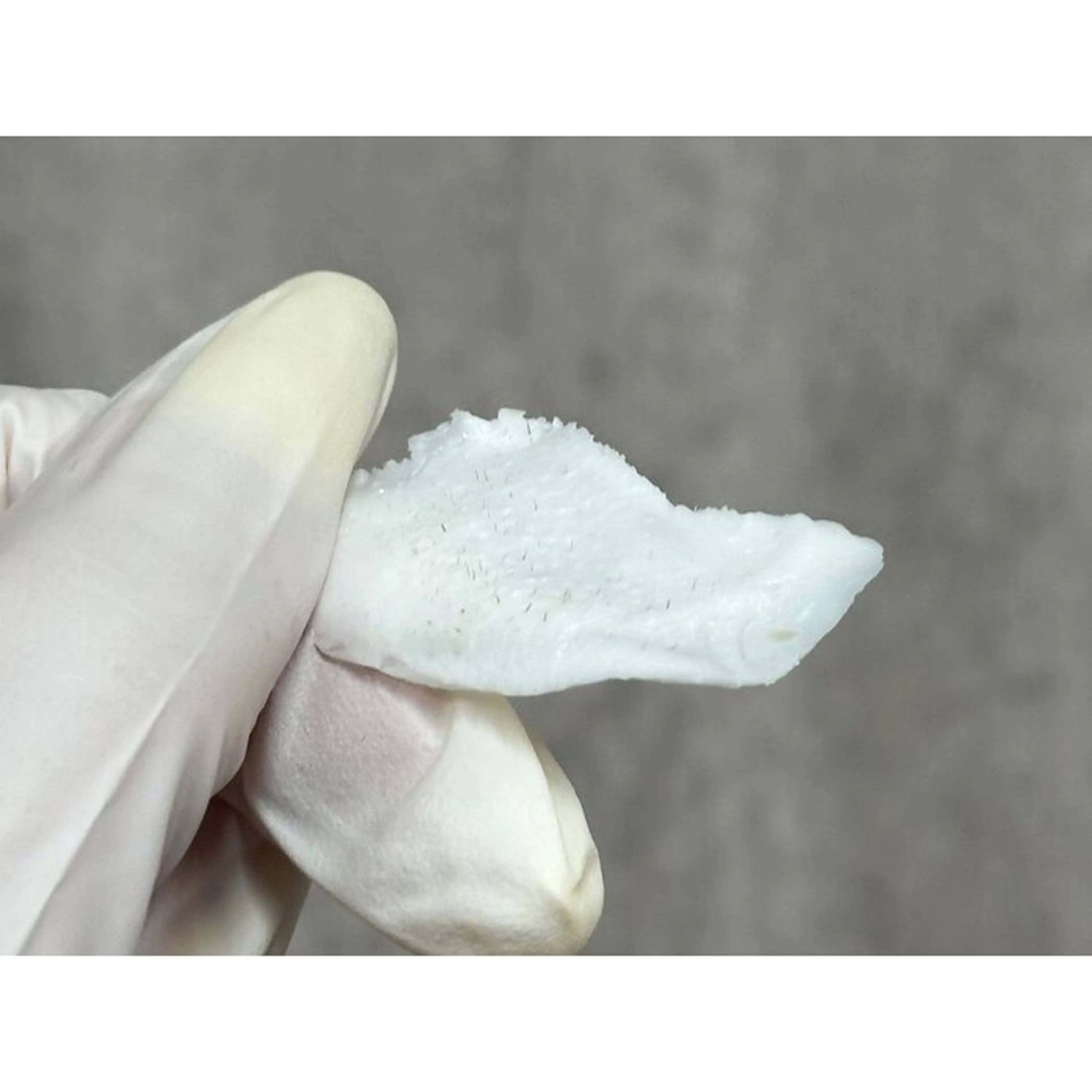 毛穴洗浄＋フェイスワックス３箇所の写真