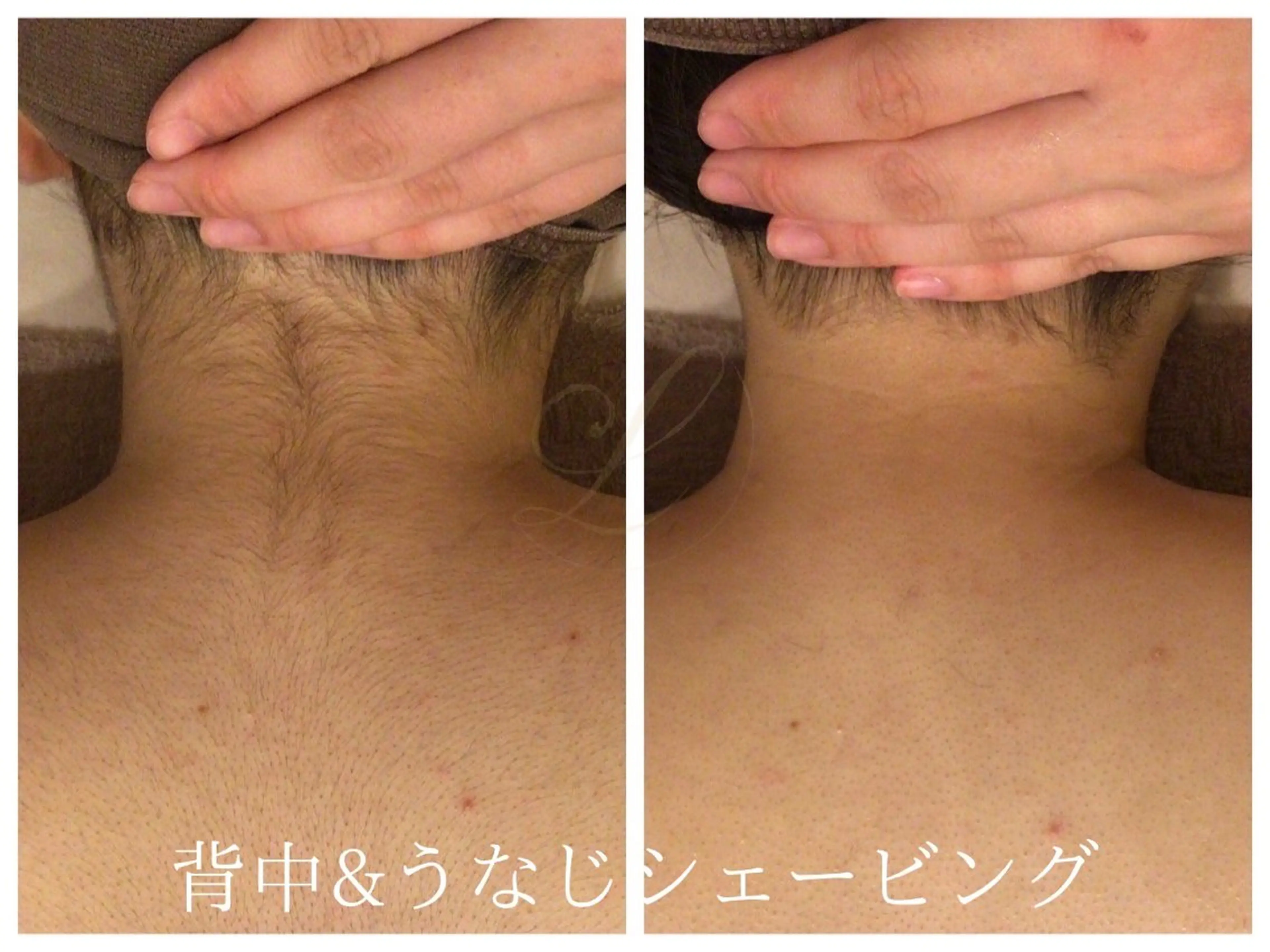 その他 Beauty  salon Lino所属・🎀うなじ脱毛🎀 ㅣLino堀江のエステ・リラクイメージ