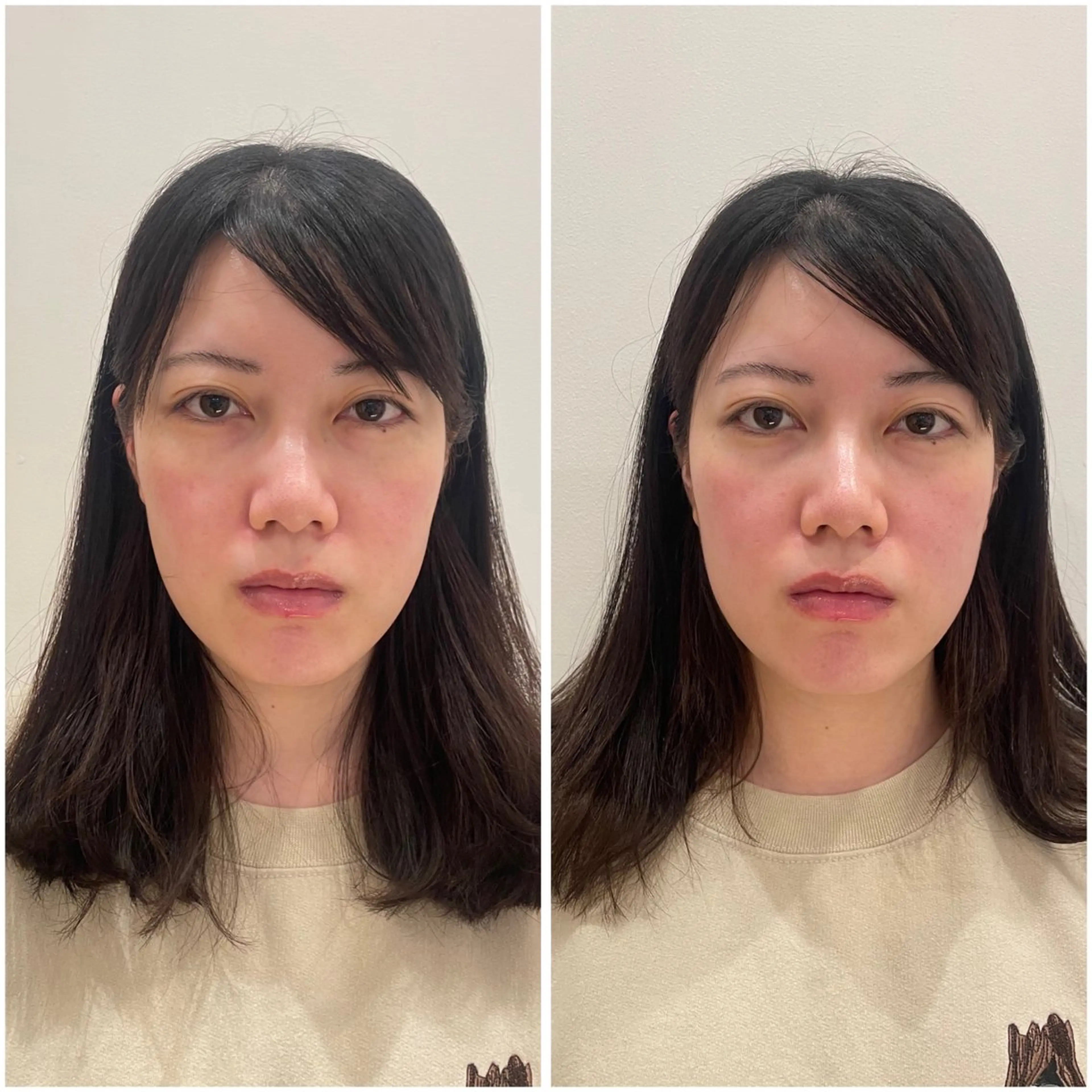 エステ リラク 美容鍼サロンメゾンブランシェ所属・🌸美容鍼サロン🌸 メゾンブランシェ🌈のエステ・リラクイメージ