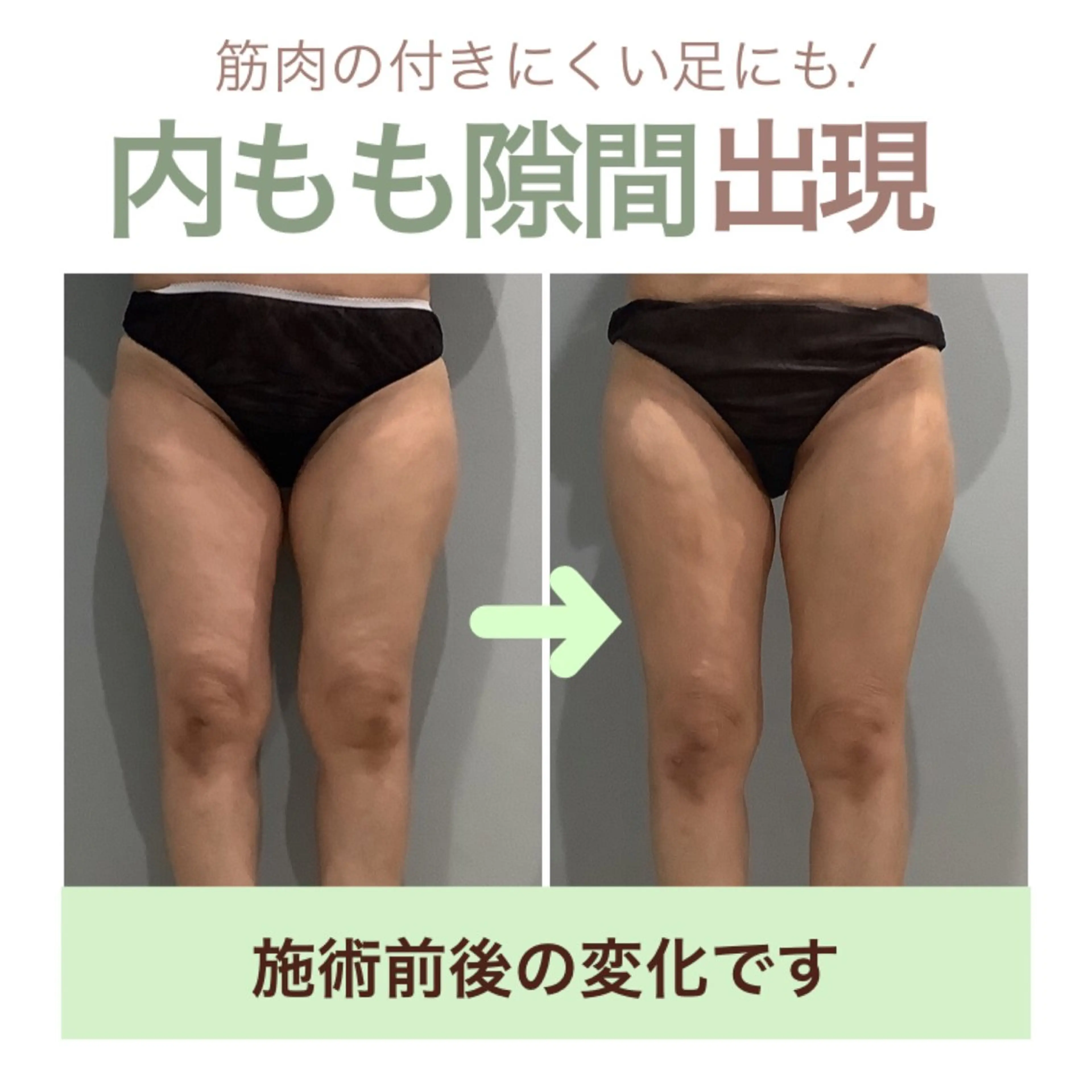 エステ エステサロン JURISのエステ・リラクイメージ