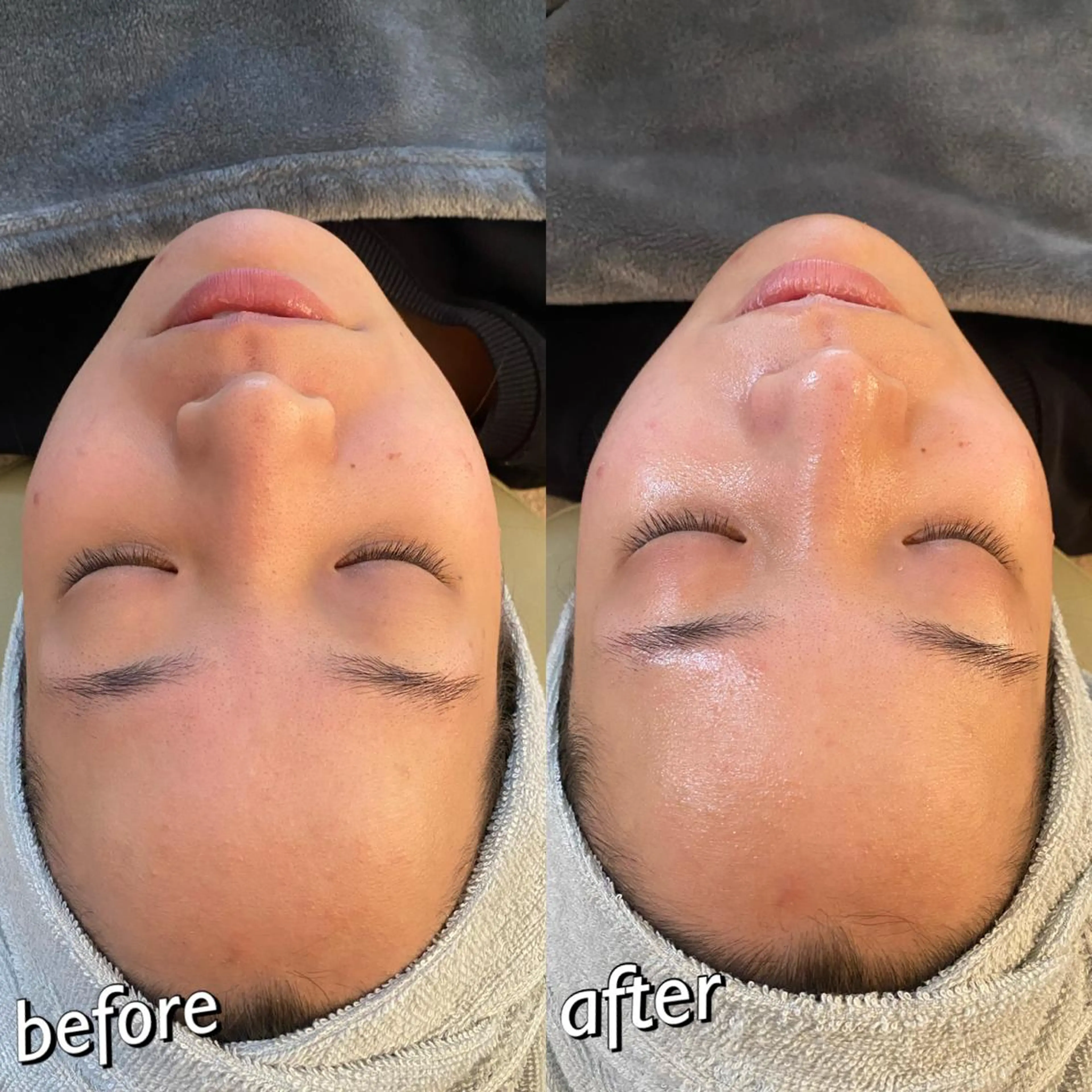 うなじ脱毛/美肌脱毛 LABELのエステ・リラクイメージ