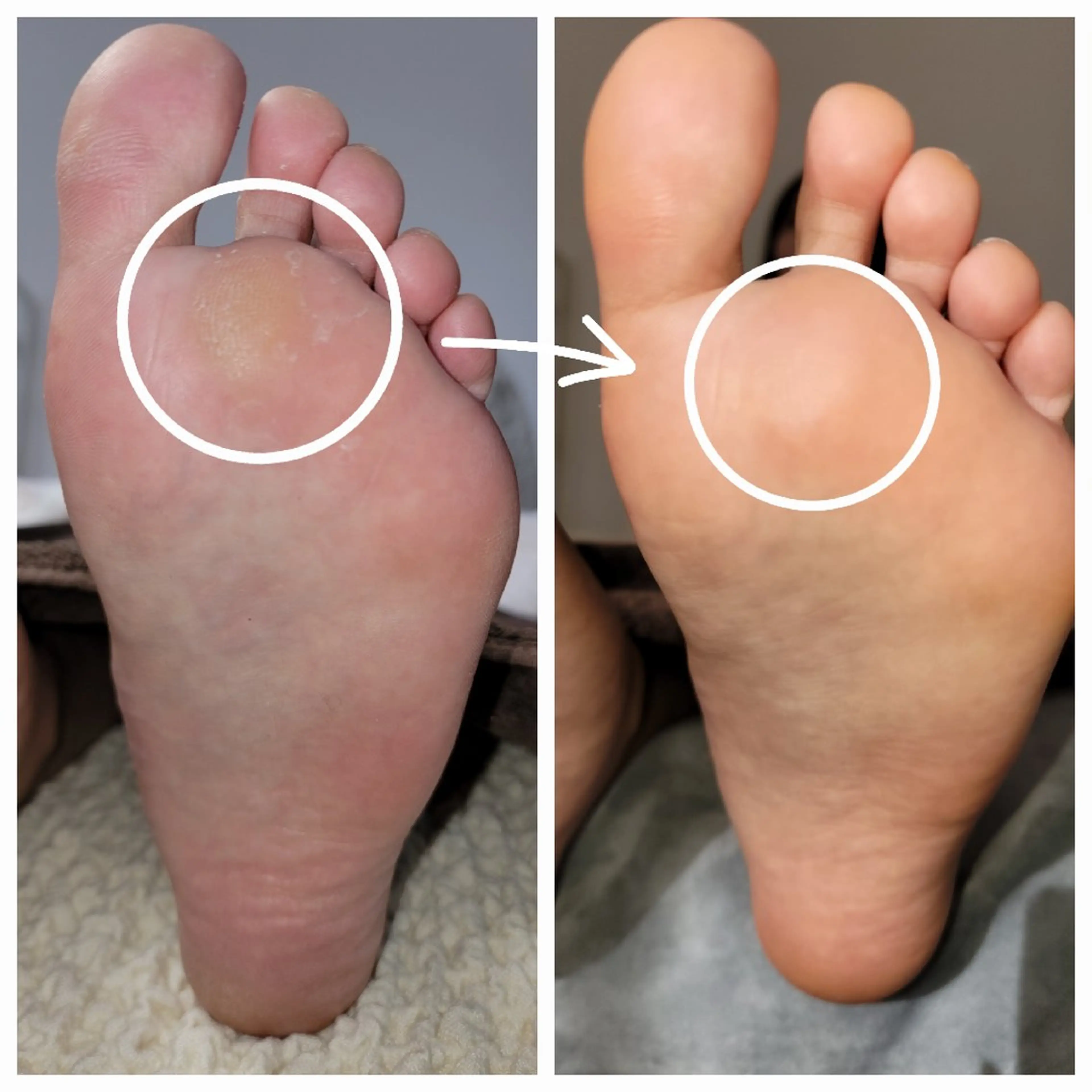 その他(ネイル) ネイル&巻き爪サロン 　AKnailのネイルデザイン