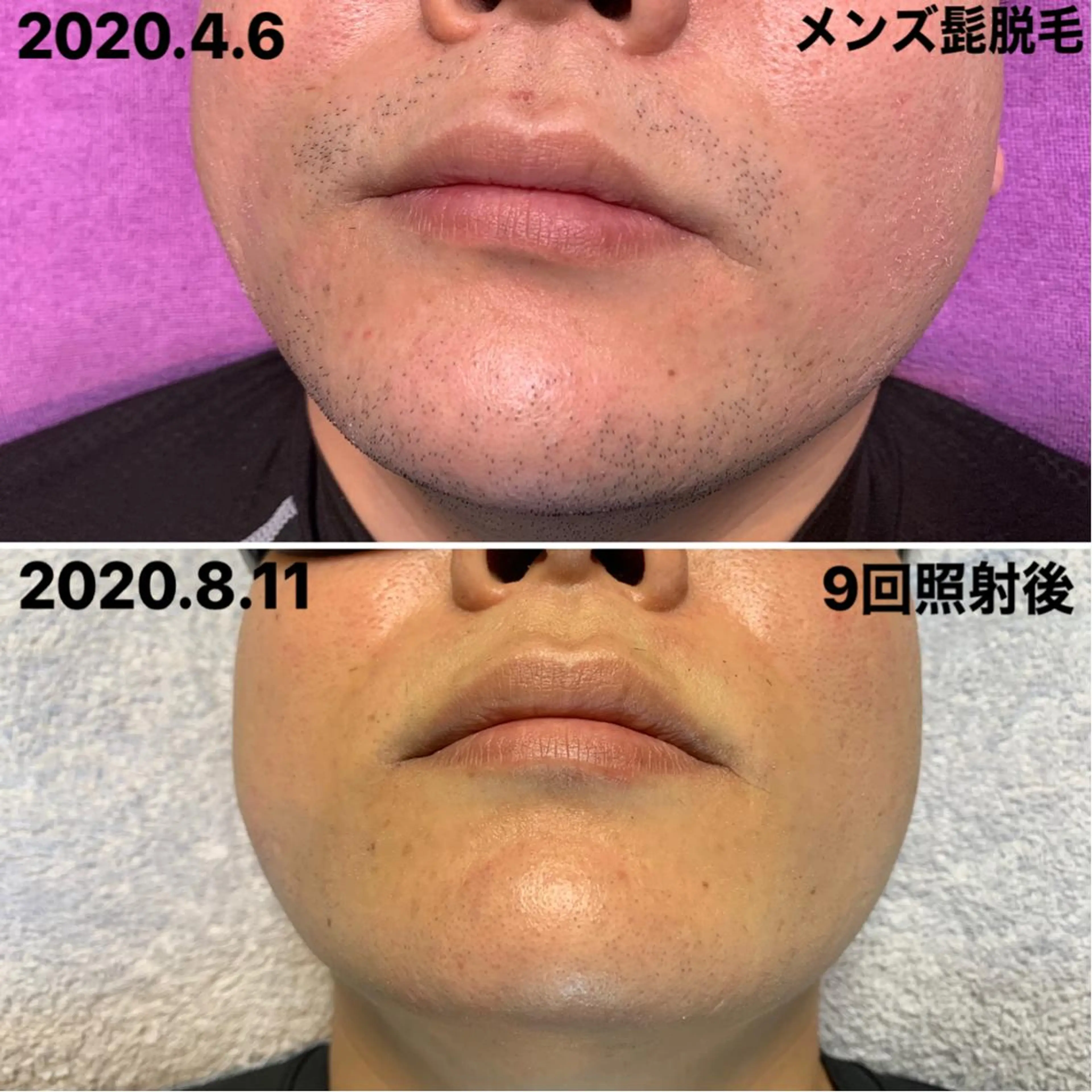 メンズ 脱毛＆エステサロン【アンリミット】所属・森谷 莉美のエステ・リラクイメージ