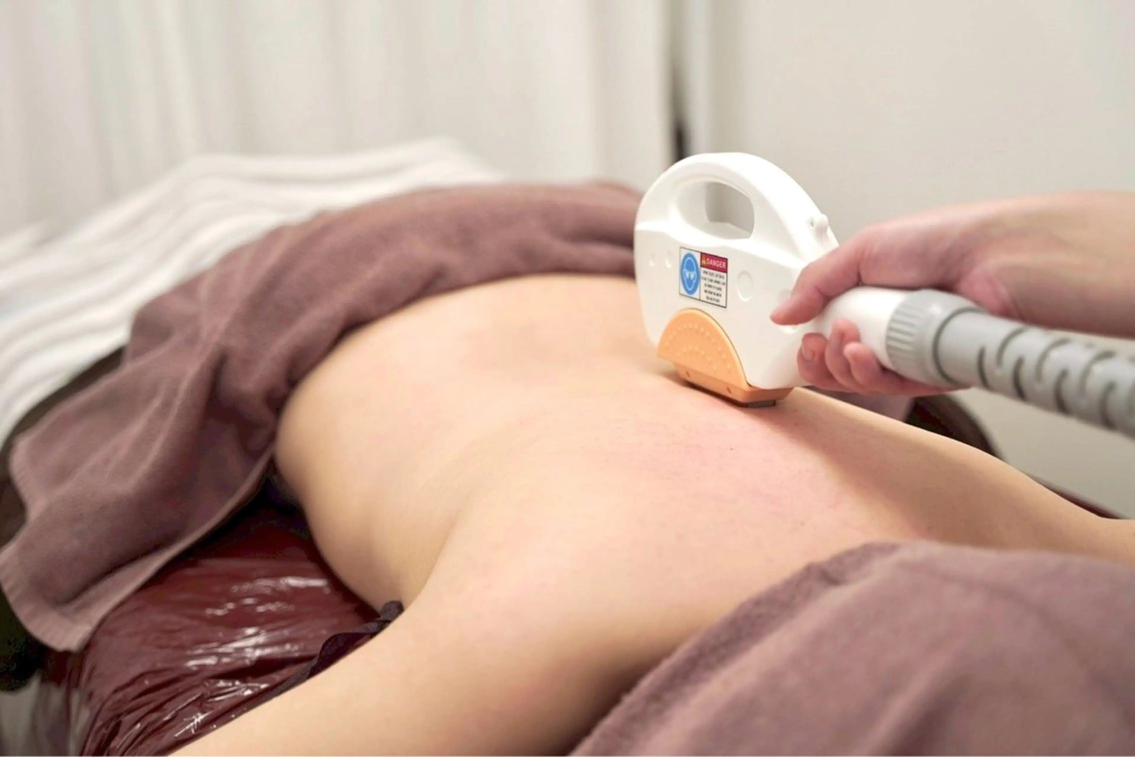 冬の間に⛄️全身脱毛（VIO込み）6回コース🤍痛みも少なく、産毛も濃い毛まで！の写真