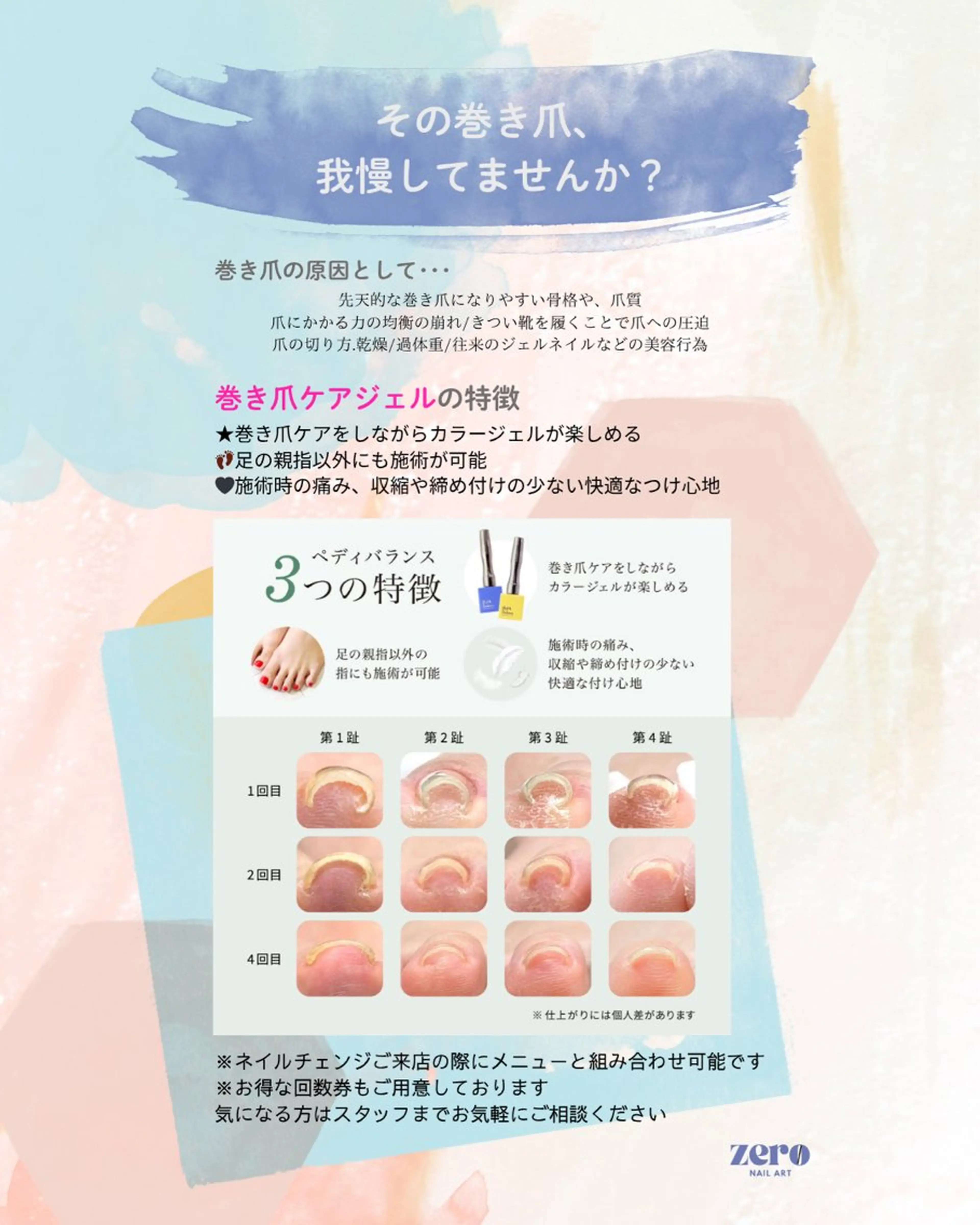 【巻き爪ケアジェル】4本（オフあり）の写真