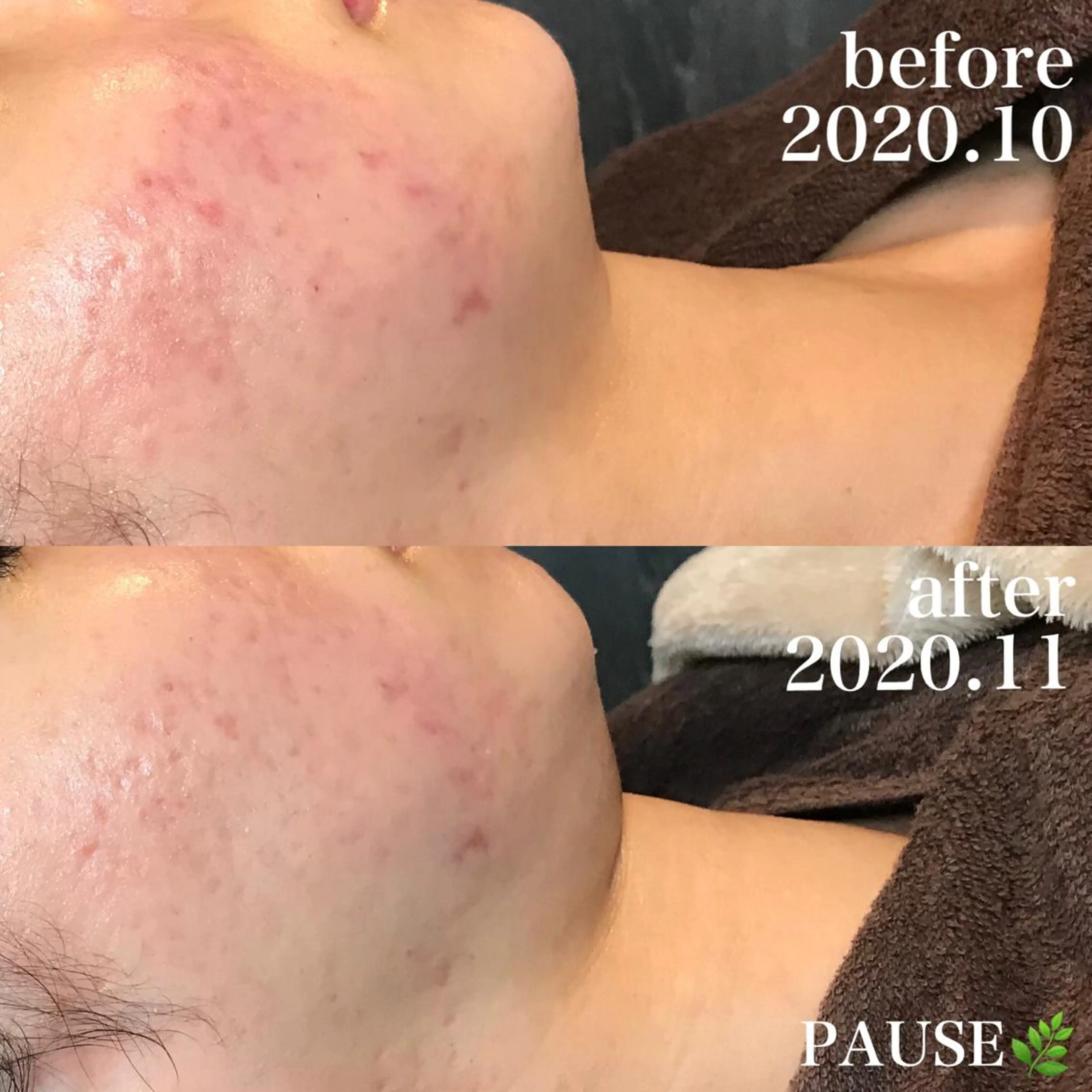 エステ 浜野 恵美のエステ・リラクイメージ