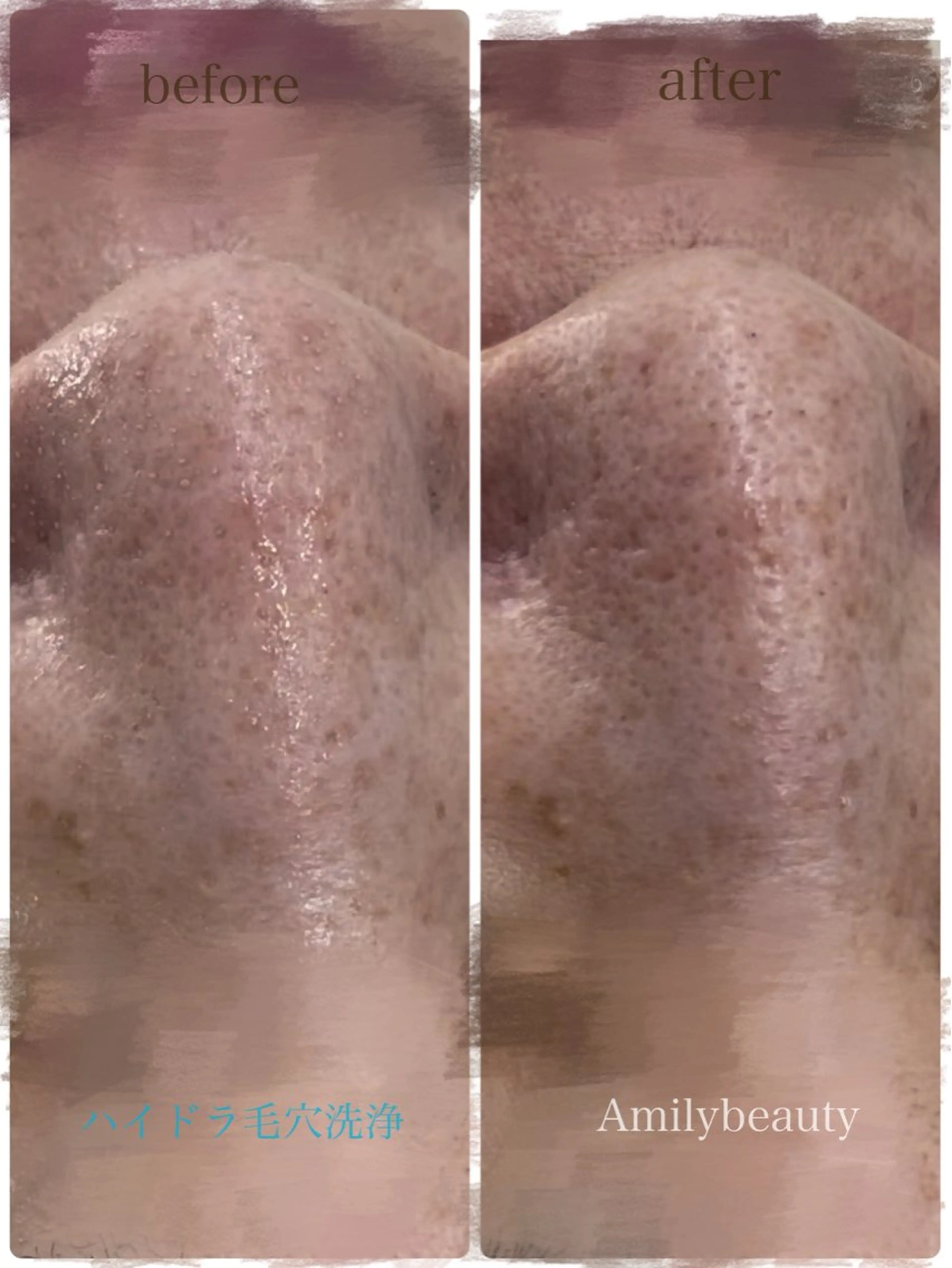 Amilybeauty所属・Amily beauty 毛利のその他イメージ