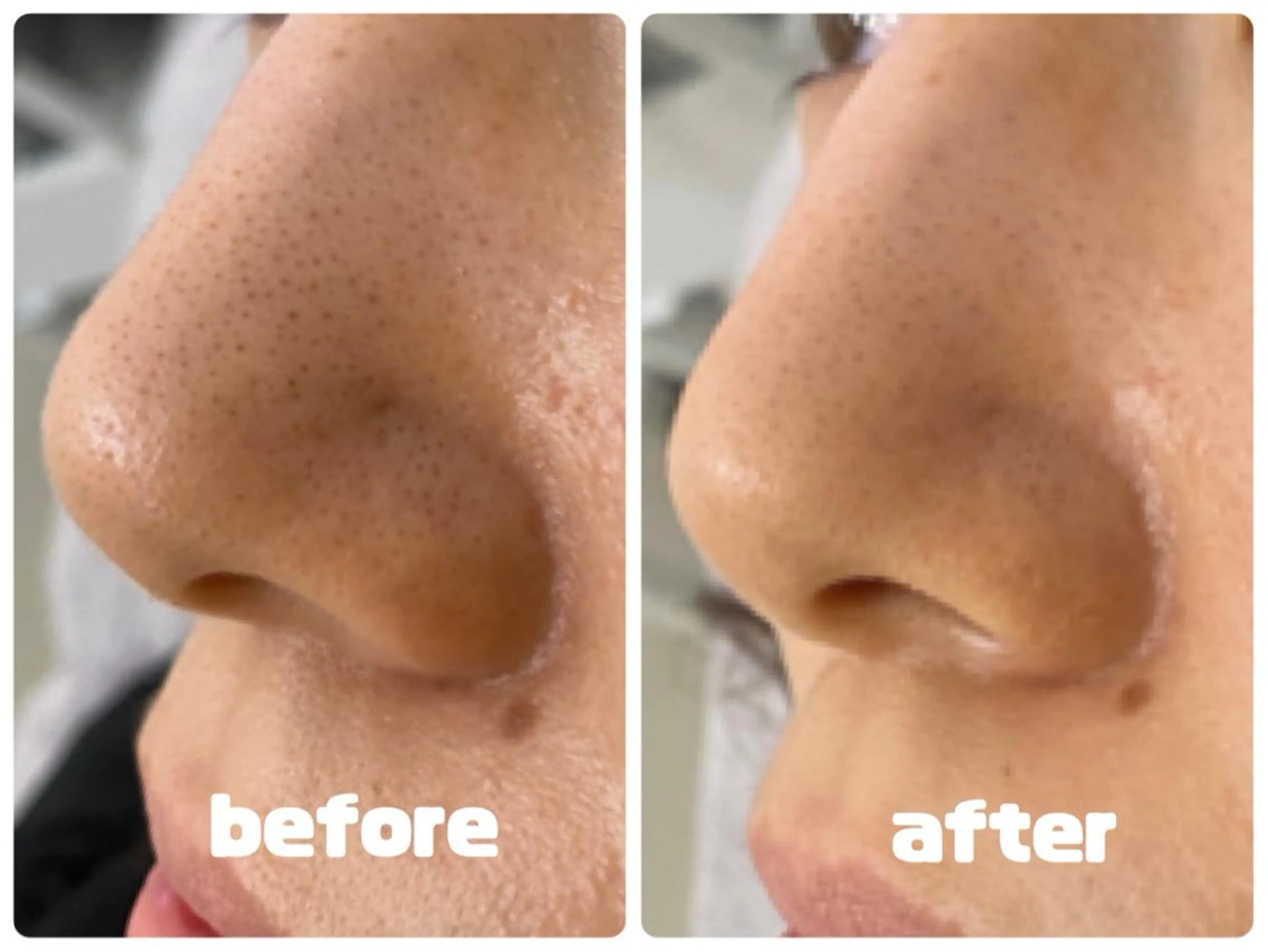 S beauteのマツエク・マツパデザイン