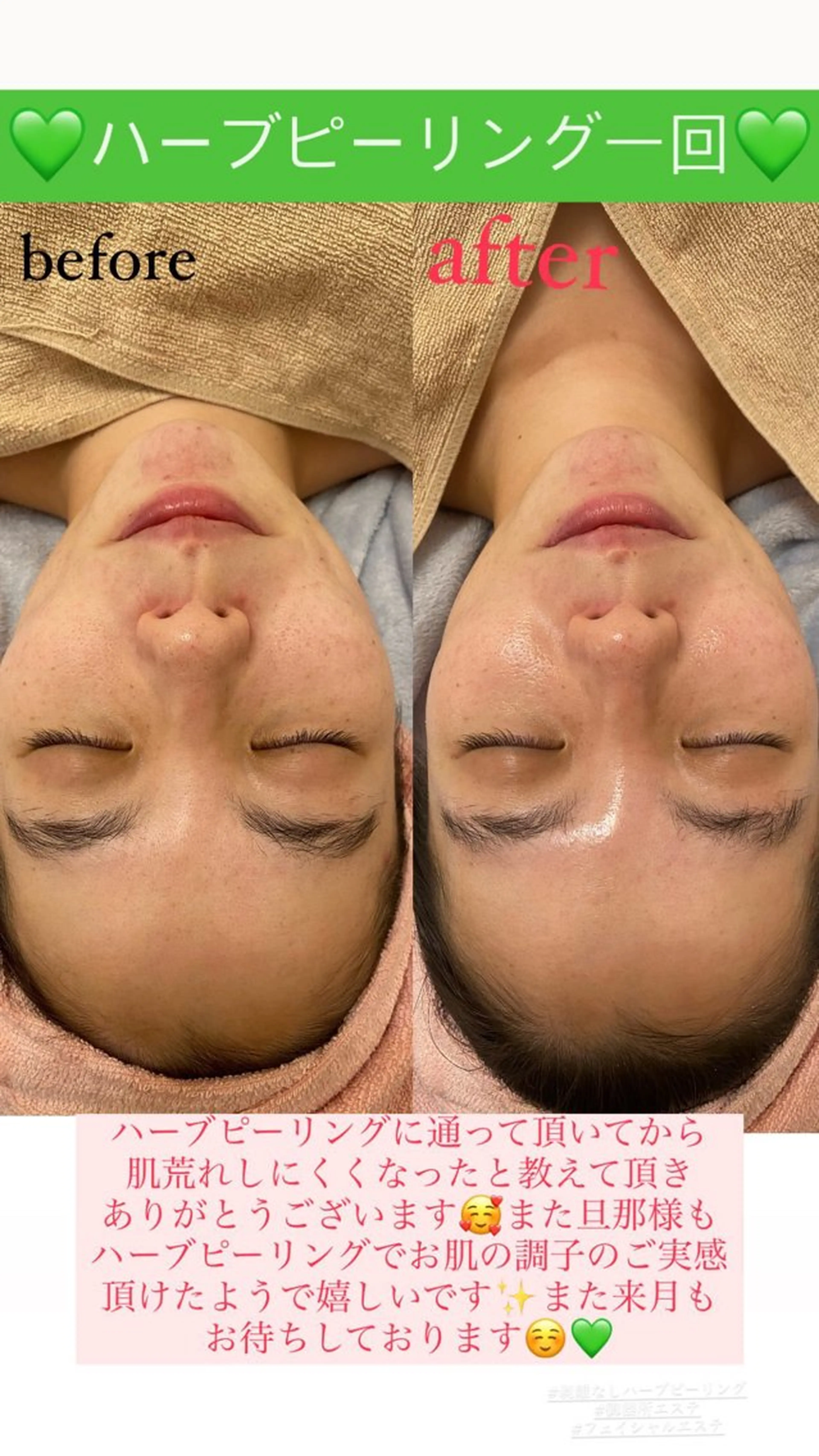 メンズ エステ Salon de Lino 御器所のエステ・リラクイメージ