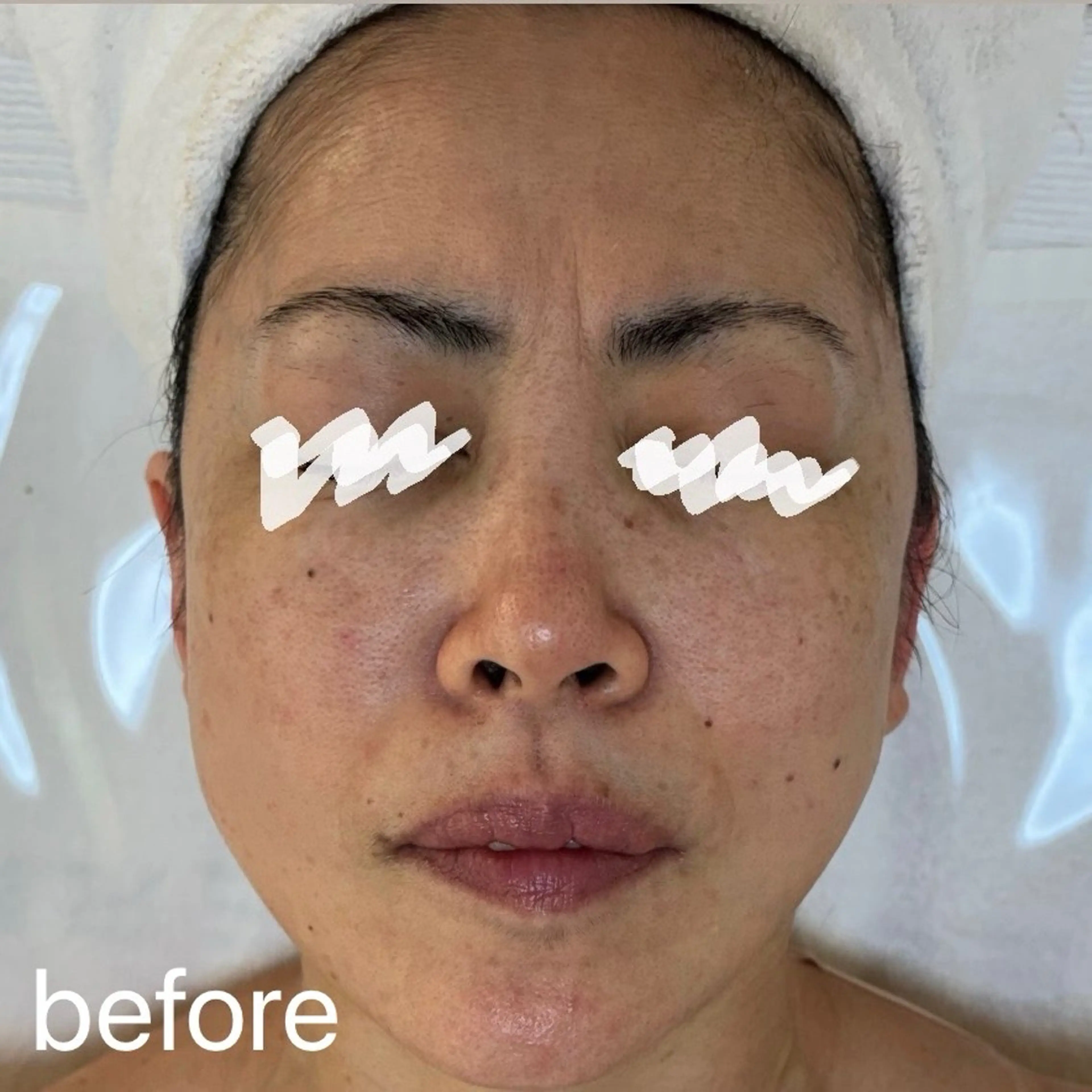 エステ 肌質改善|天王寺 For...はるかのエステ・リラクイメージ