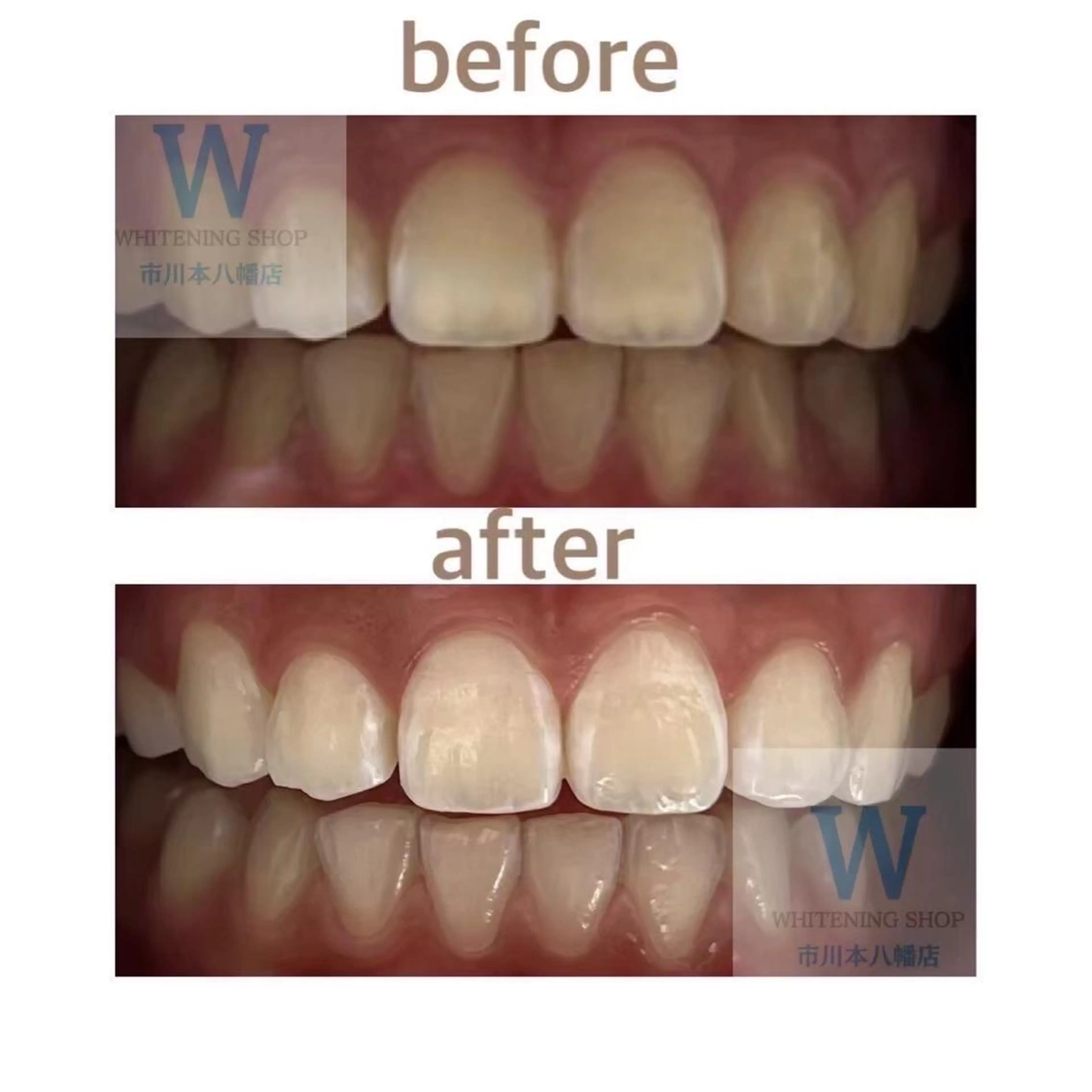 メンズ その他 ホワイトニング ショップ本八幡店のエステ・リラクイメージ