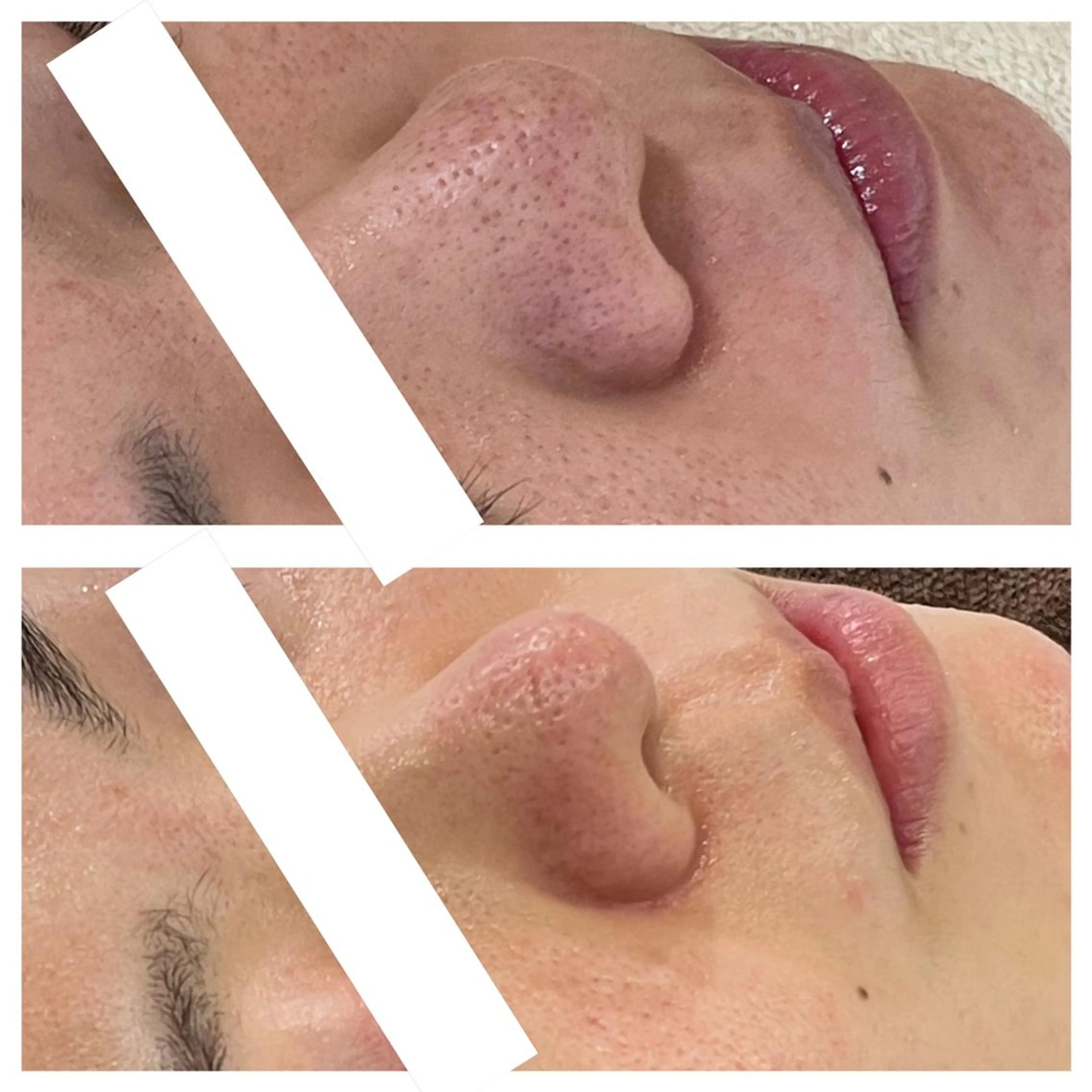 部分痩せ♥️小顔専門 MIKUのエステ・リラクイメージ