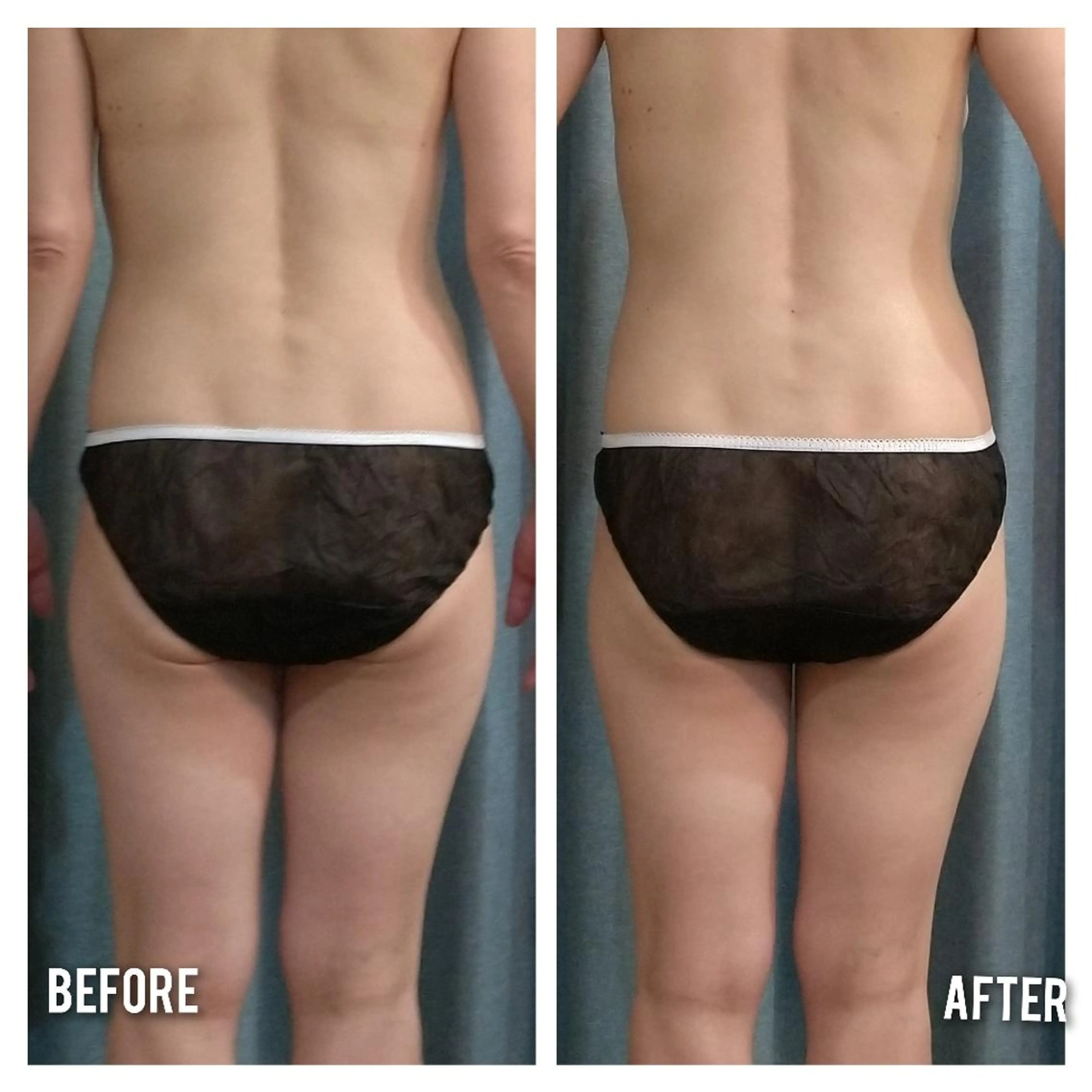 エステ Beauty Salon AQUA所属・Beauty Salon AQUAのエステ・リラクイメージ