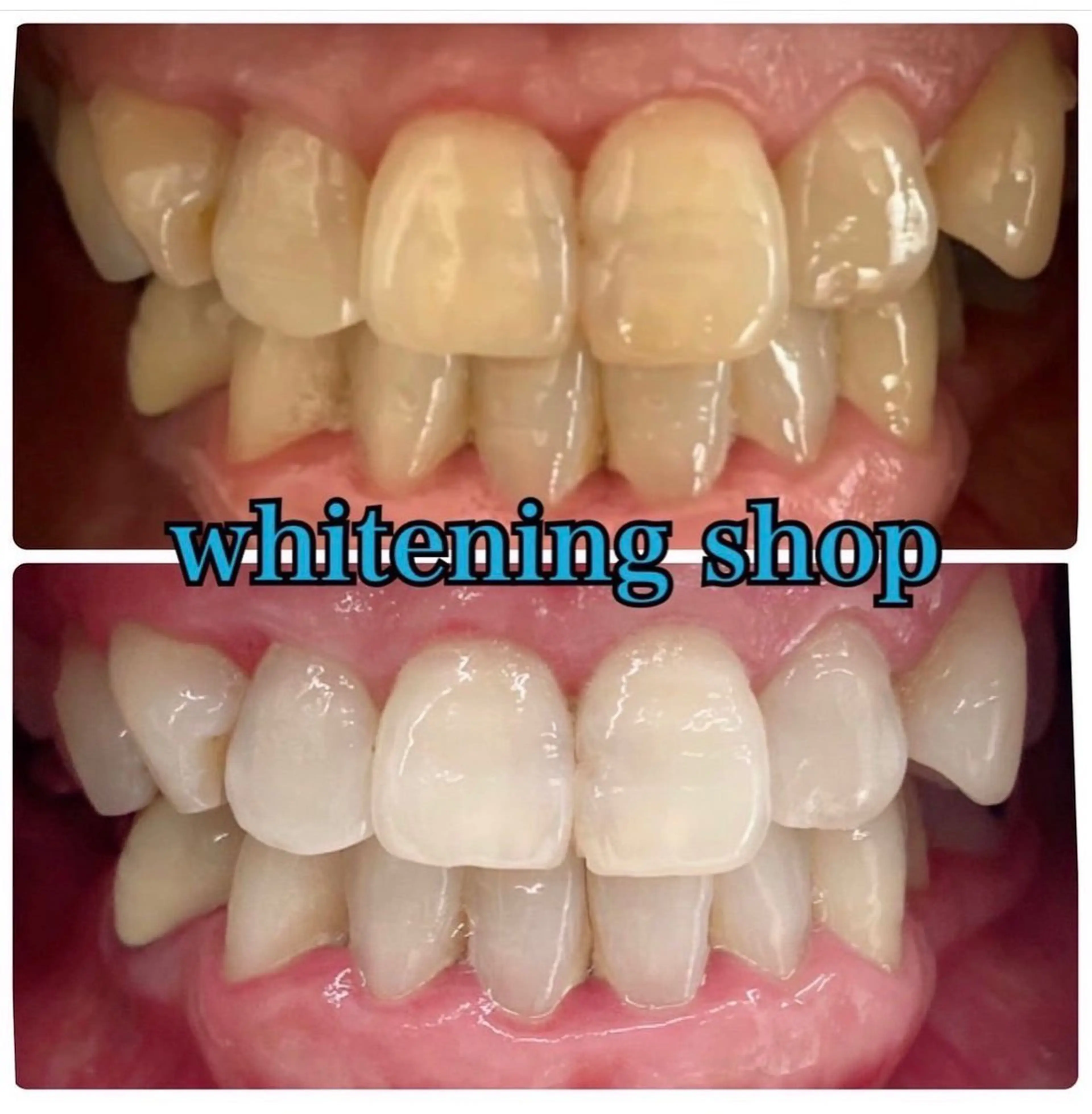 エステ リラク ホワイトニング ショップ吉祥寺店のエステ・リラクイメージ