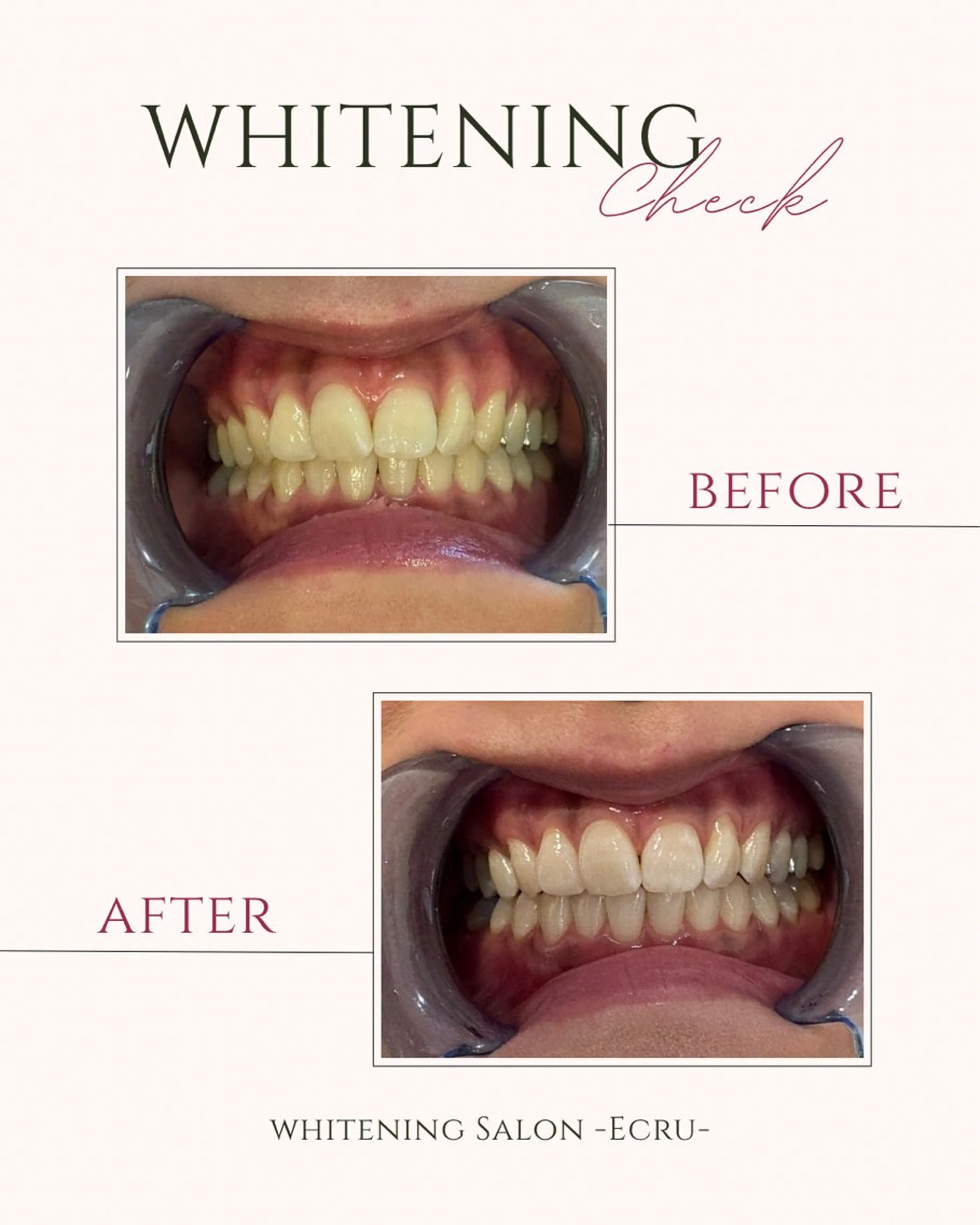 その他 ホワイトニングサロン Ecru所属・ホワイトニングサロン Ecru エクリュのその他イメージ
