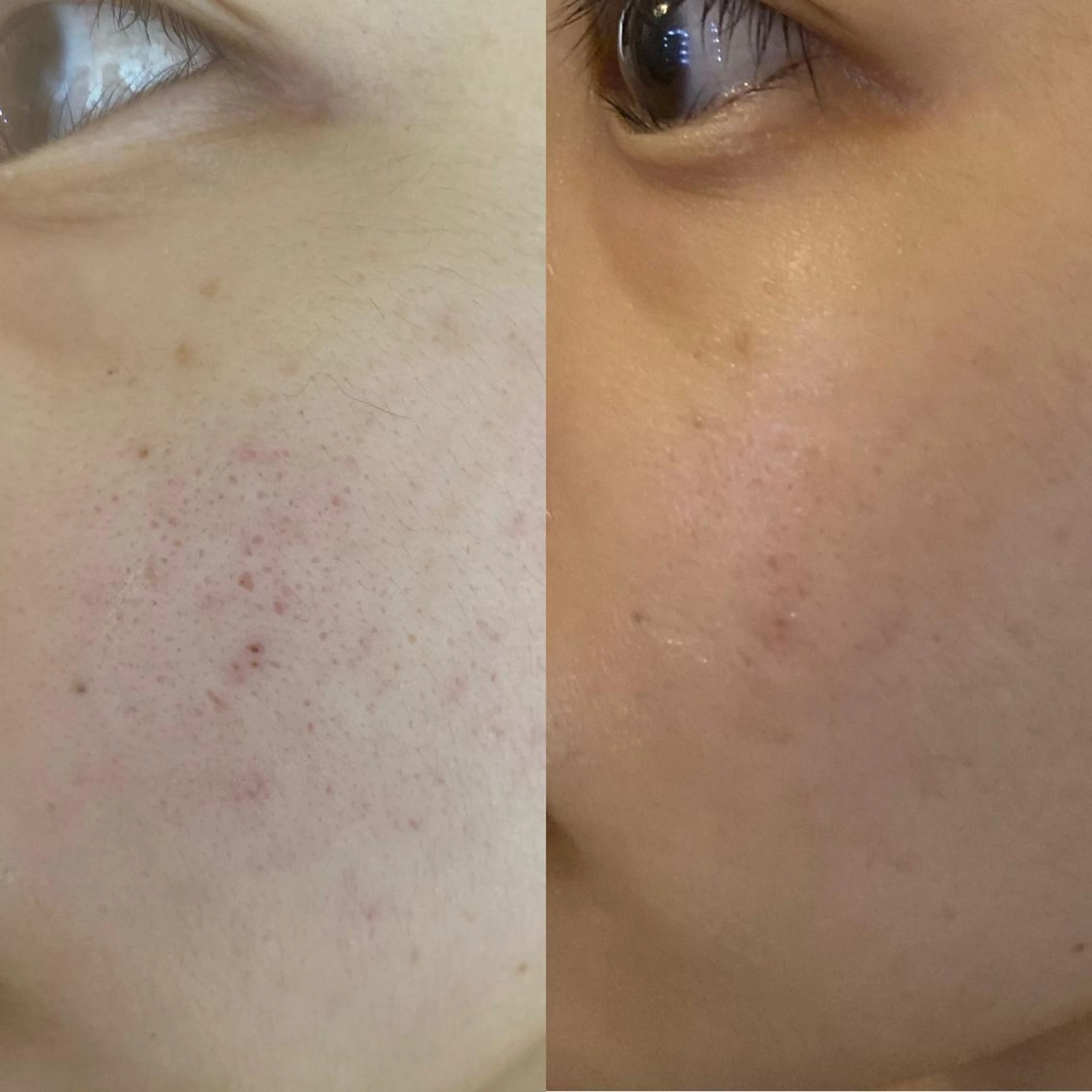 Meetite 小林のエステ・リラクイメージ