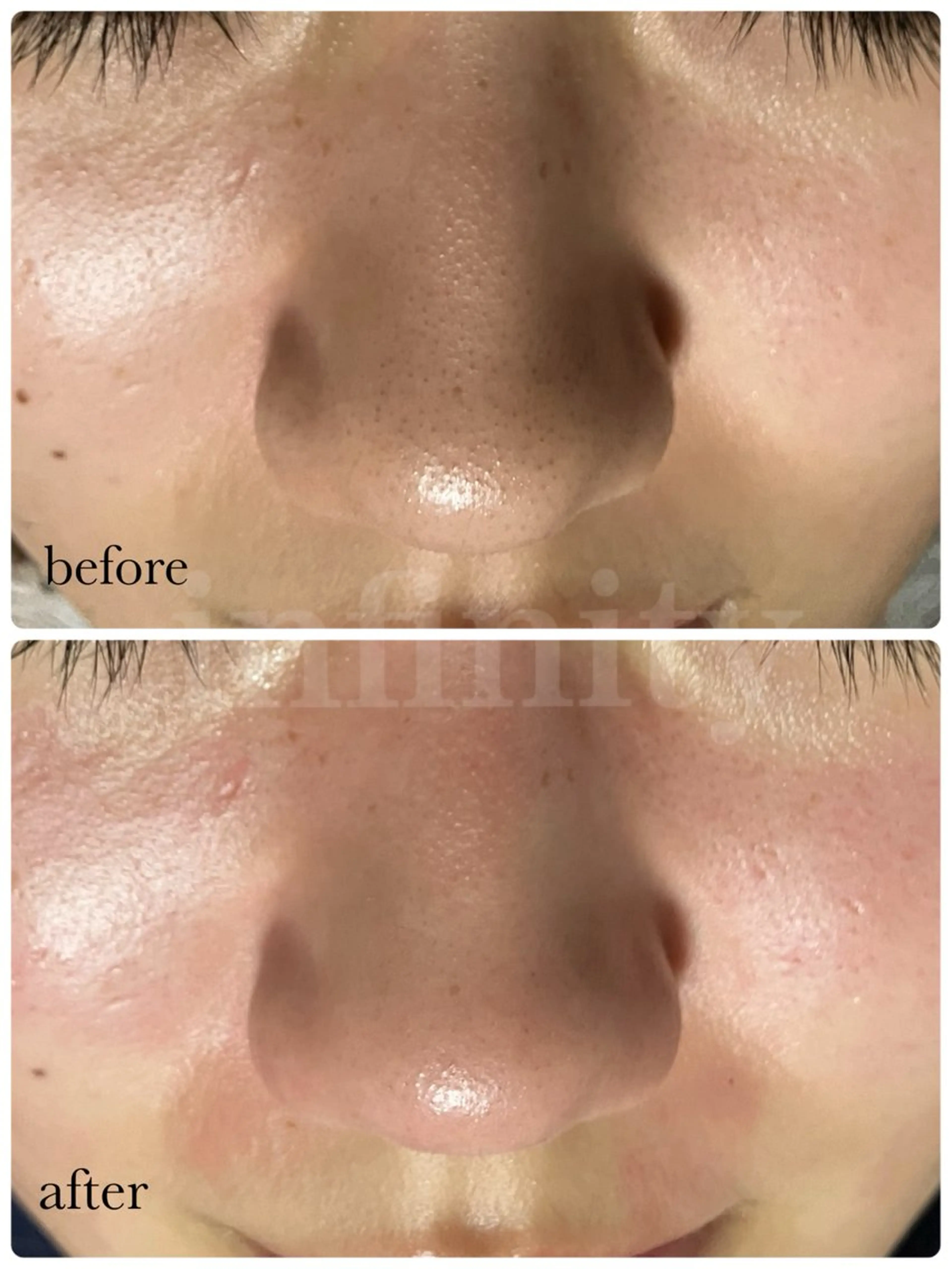 その他 infinity所属・Infinity インフィニティのその他イメージ