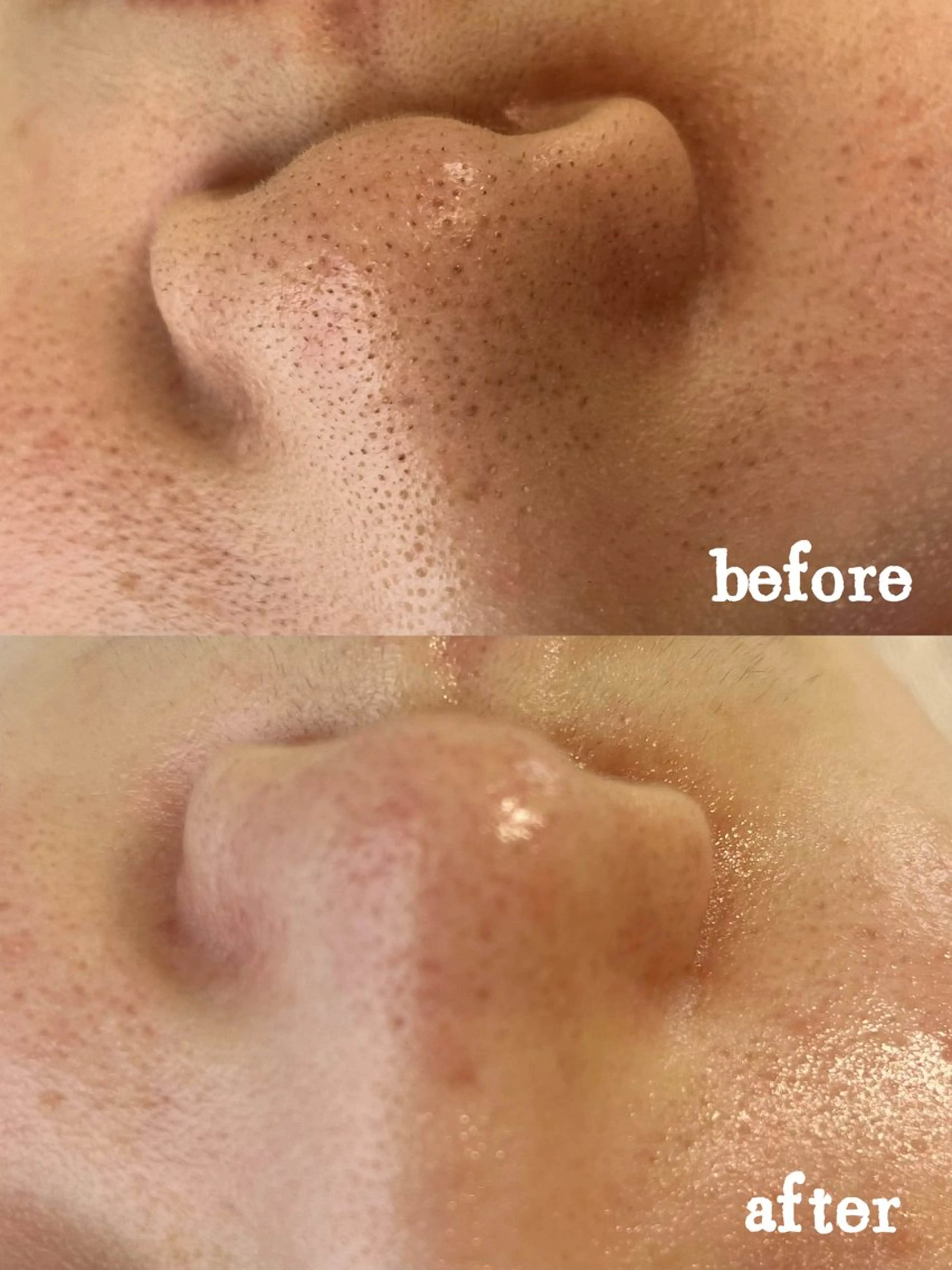 Nature Souce毛穴専門店のその他イメージ