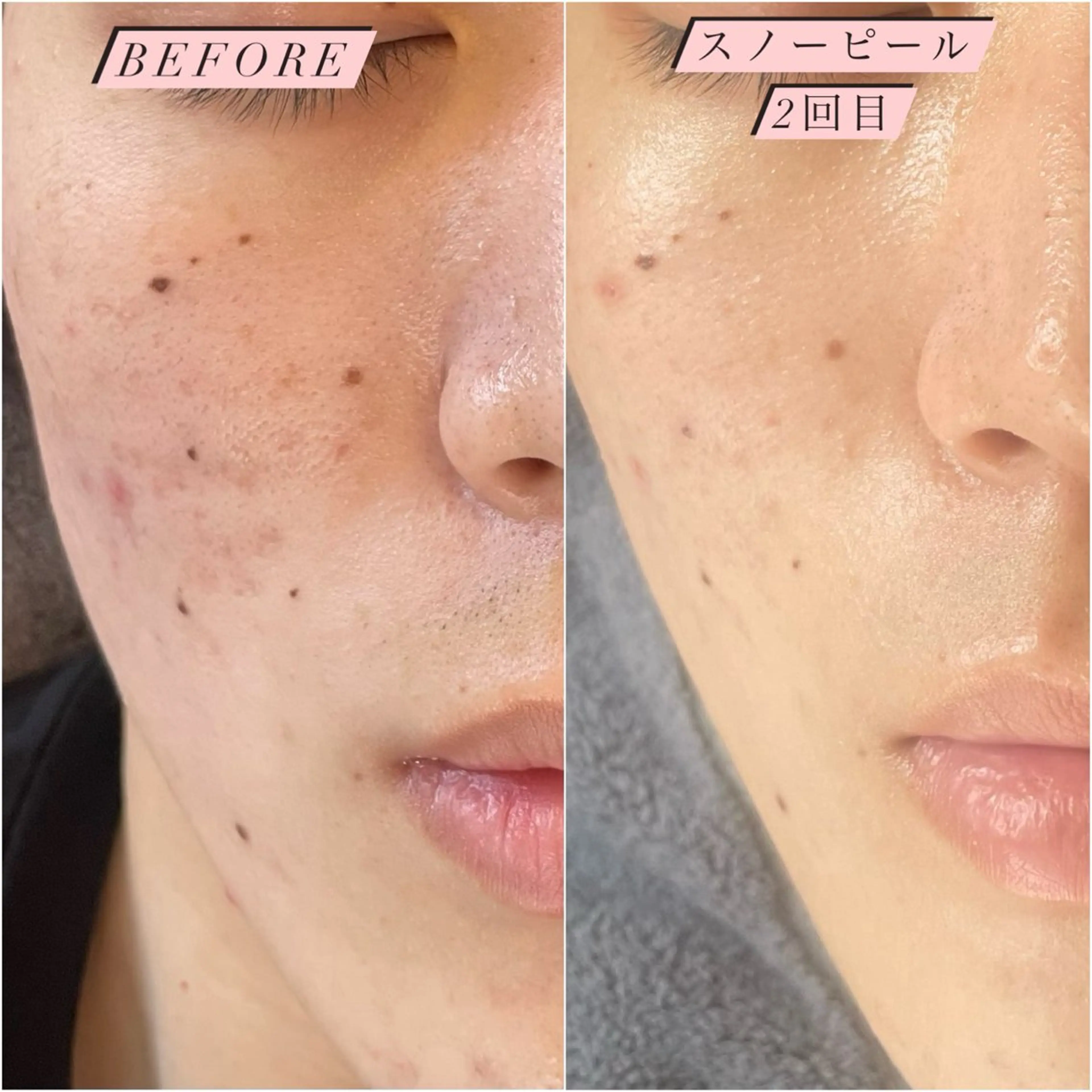 フィユ所属・〚博多〛フィユ 水江のマツエク・マツパデザイン