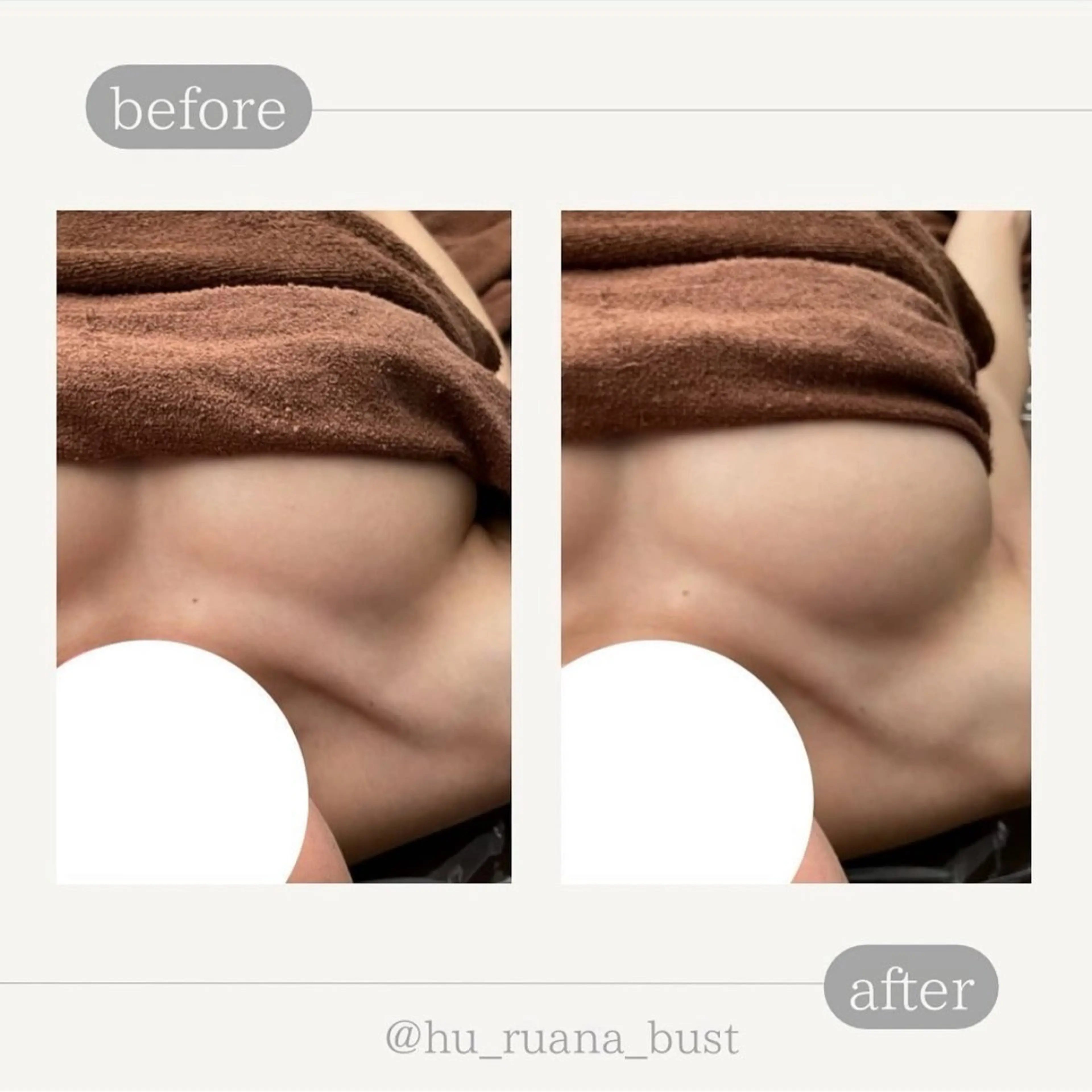 巻き肩改善！バストケアモニター募集　¥22,000→¥5,000の写真